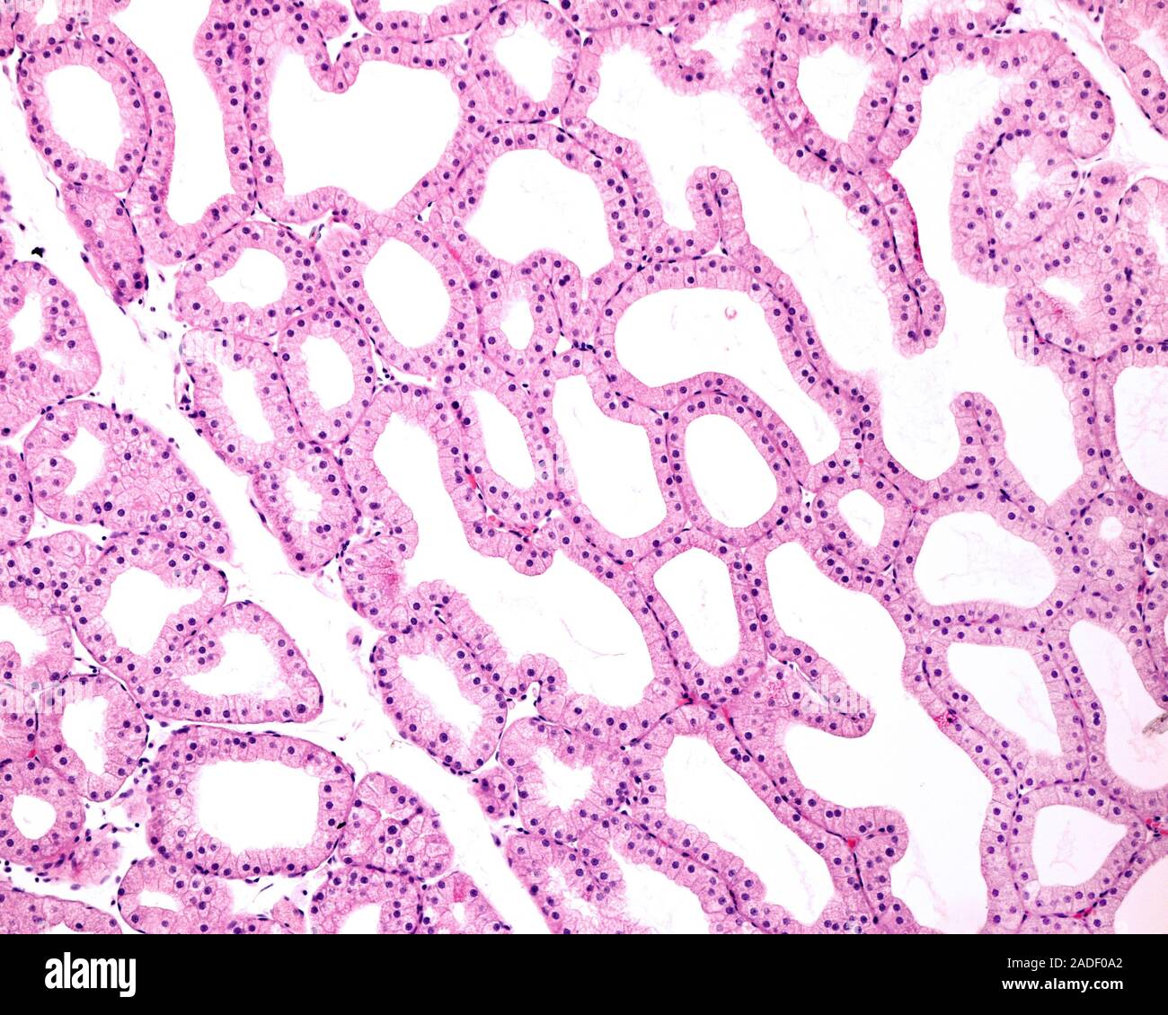 Light micrograph showing secretory units of a lacrimal gland. The