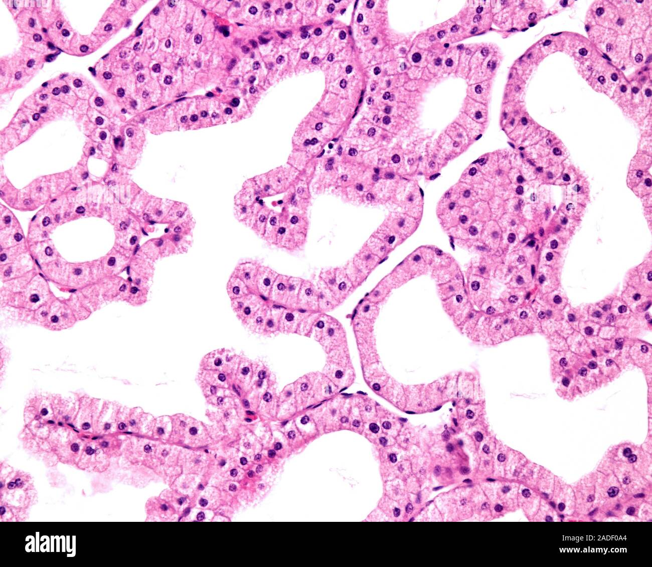 Light micrograph showing secretory units of a lacrimal gland. The