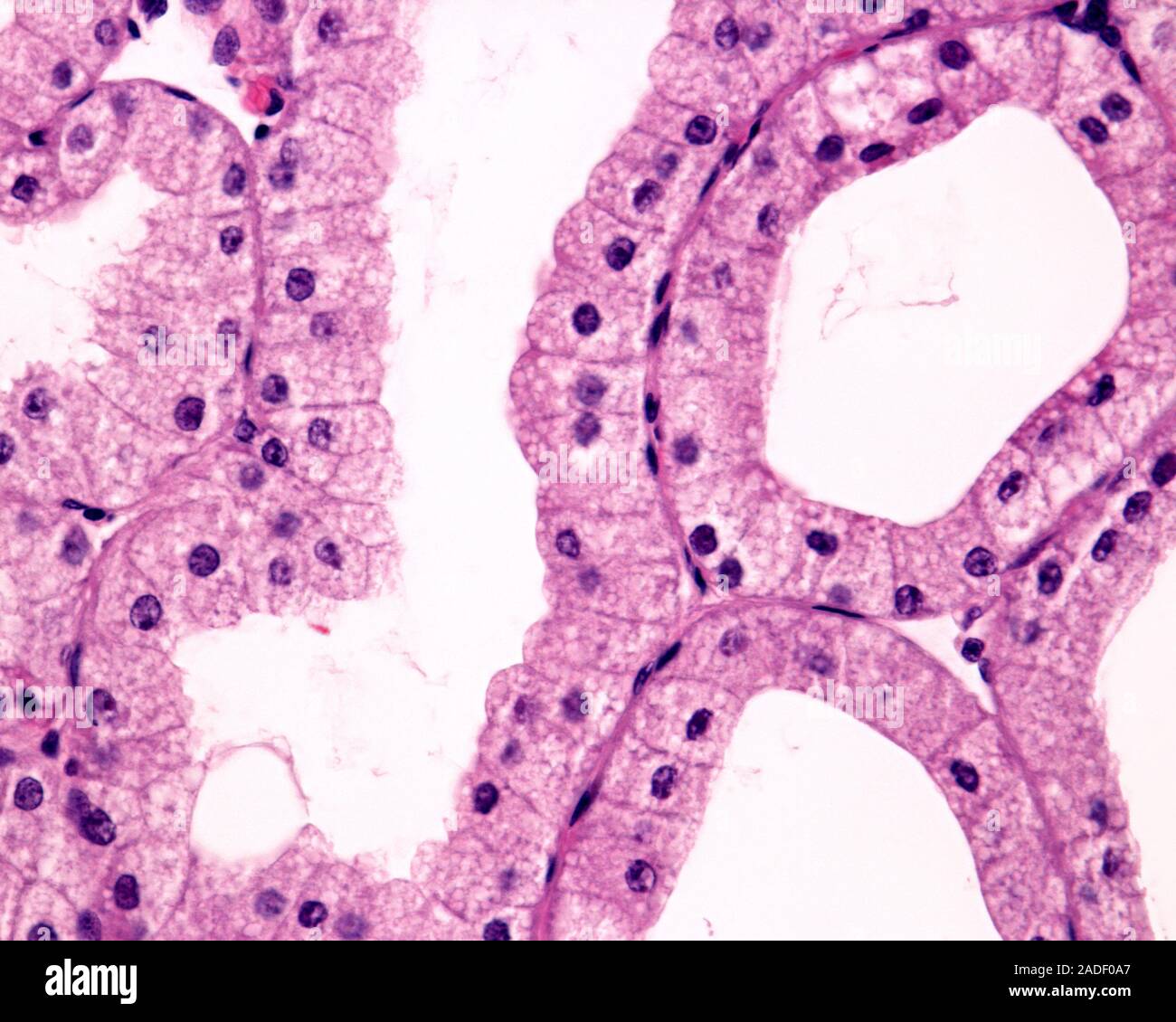 High magnification light micrograph showing secretory units of a