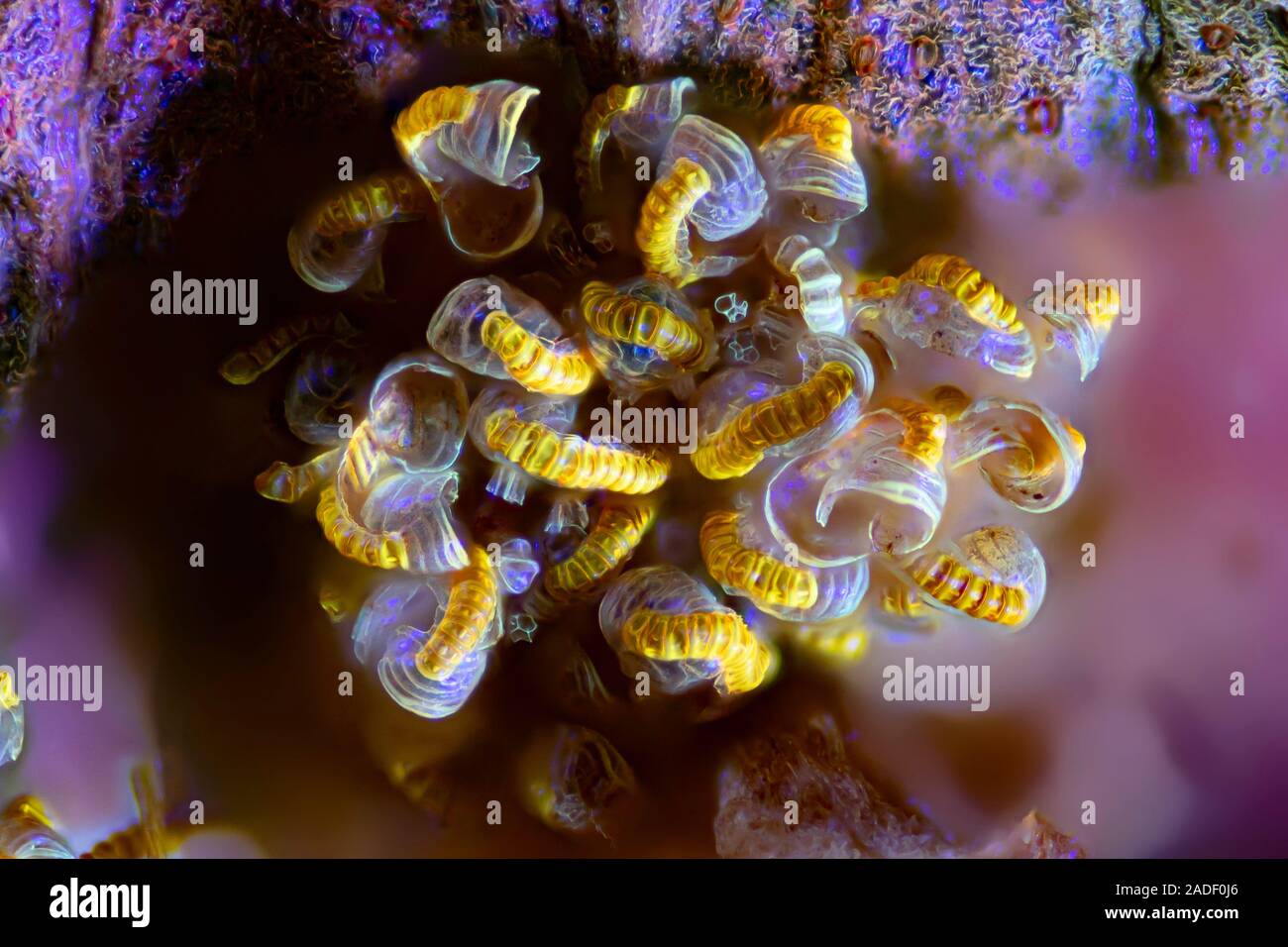 Fern sorus. Fluorescence light micrograph of a sorus on the underside