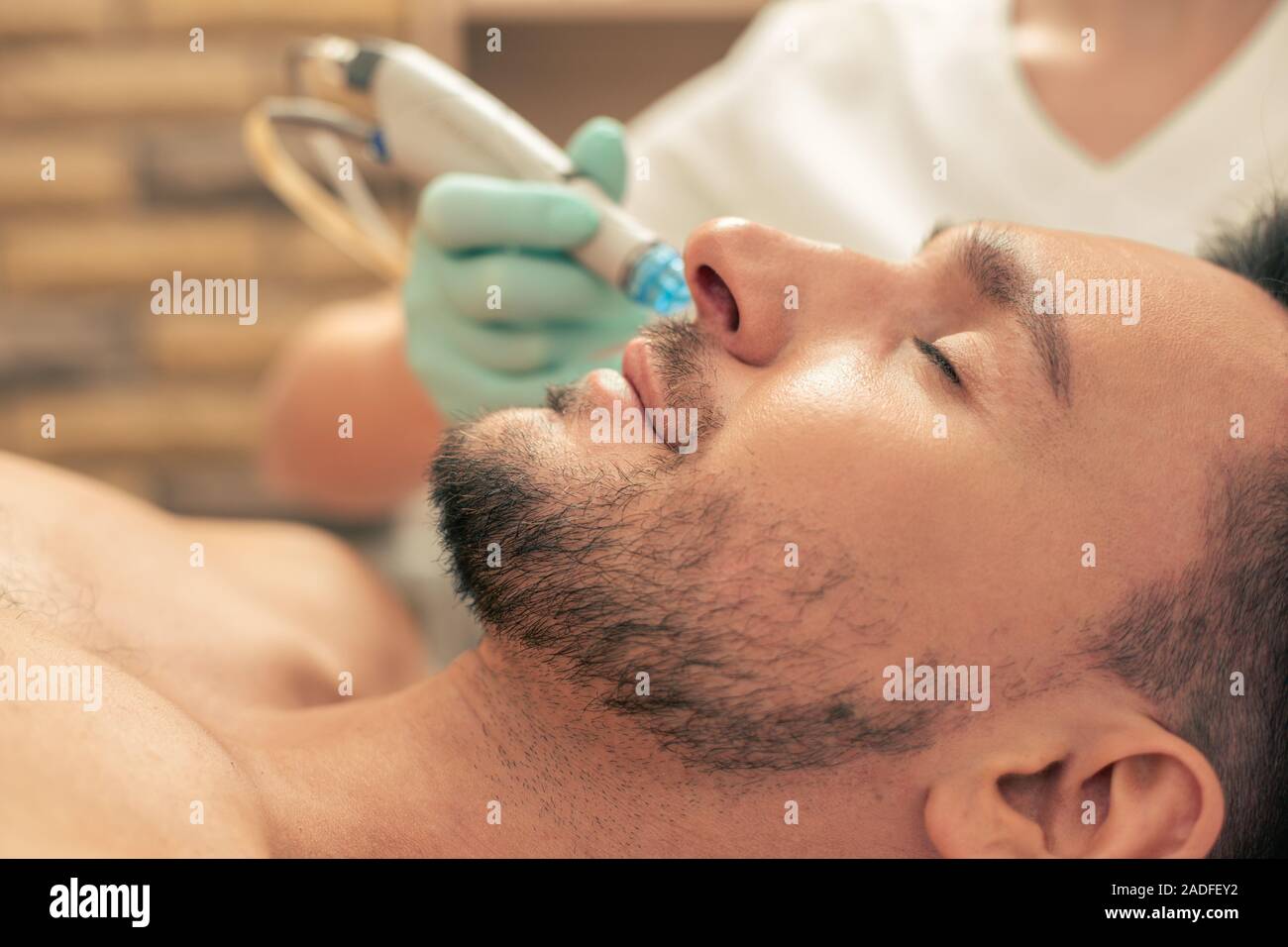 Skin procedure hi-res stock photography and images - Alamy