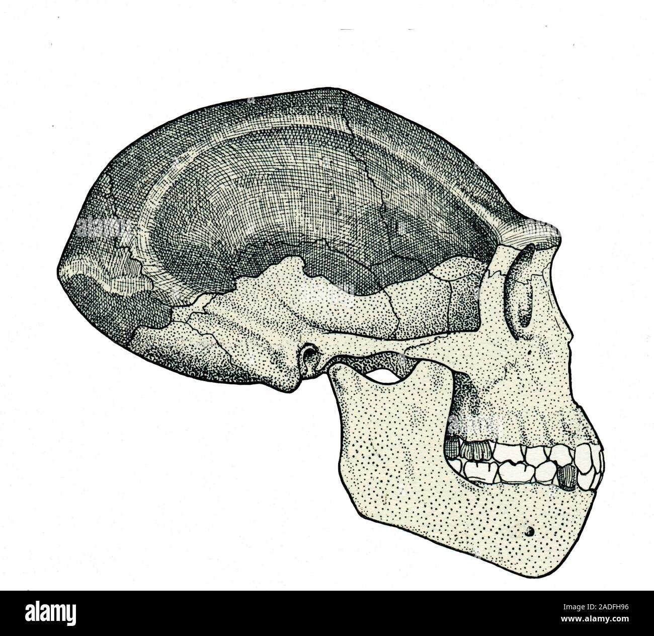 Homo erectus skull. Artwork, from 1931, showing a reconstruction of the ...