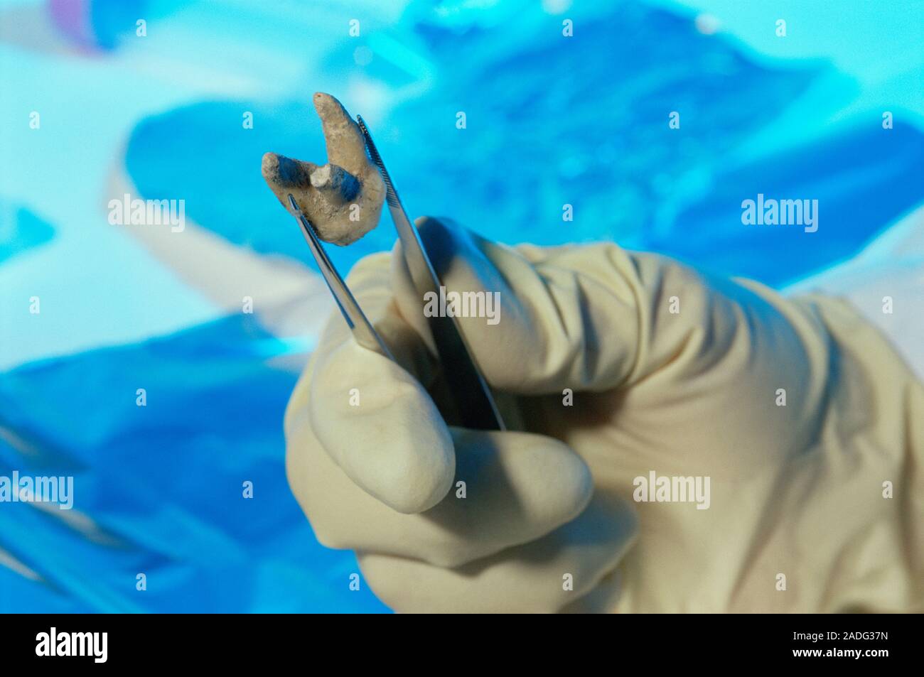 DNA analysis of Peruvian mummy. Mummy's tooth being used in DNA