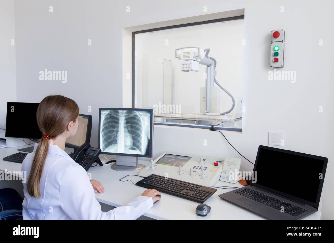 Woman chest x ray hi-res stock photography and images - Alamy