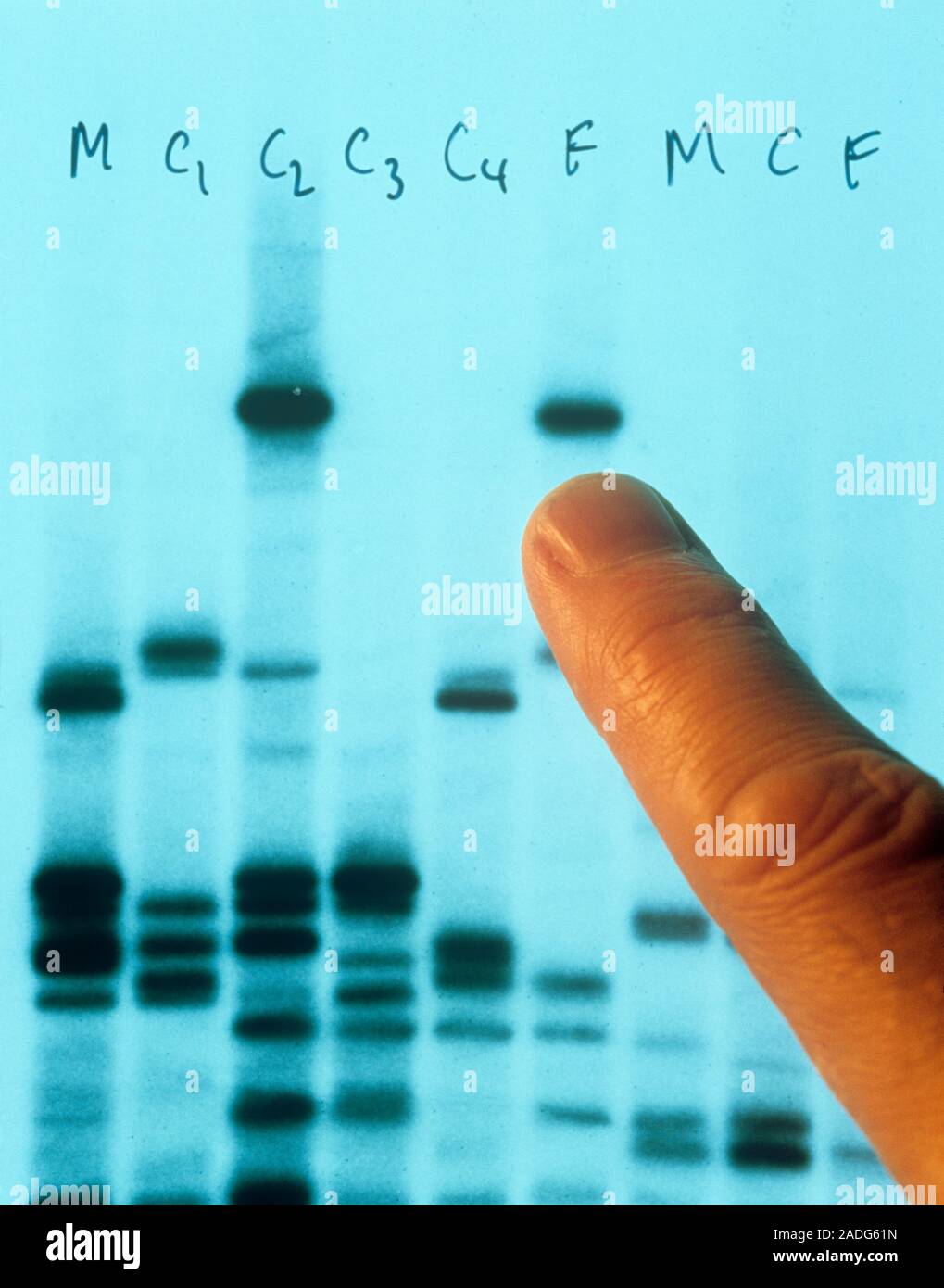 DNA fingerprinting used to prove paternity. The photo shows part of an ...