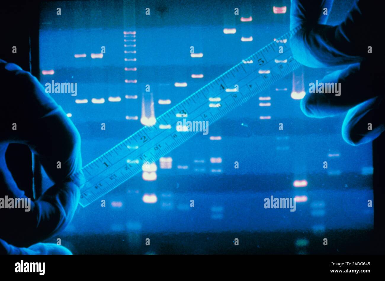 DNA fingerprinting. View of gloved hands holding a ruler to measure ...