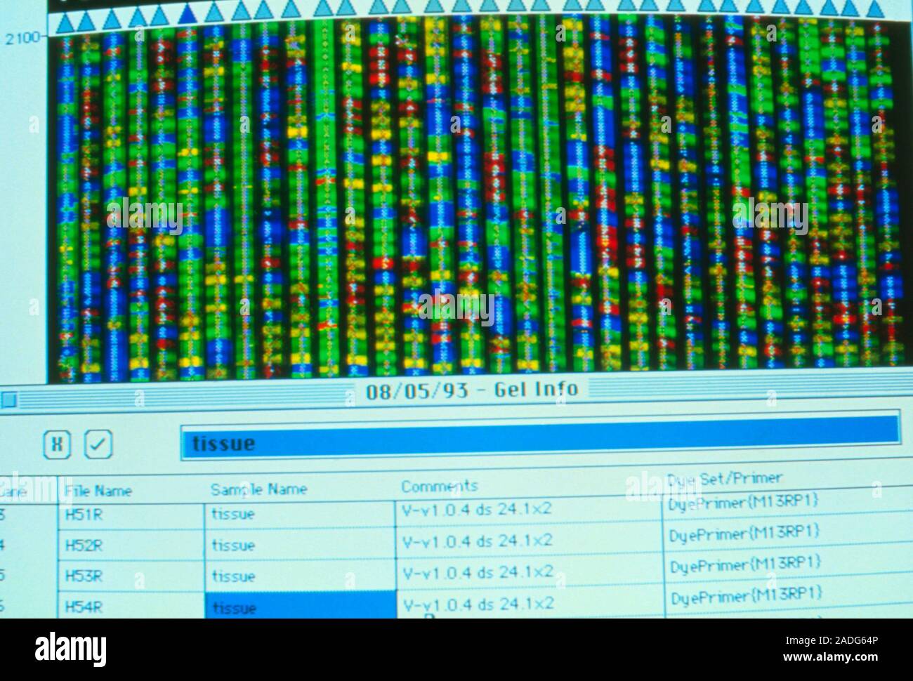 DNA sequencing. Computer image of a coloured auto radiogram showing