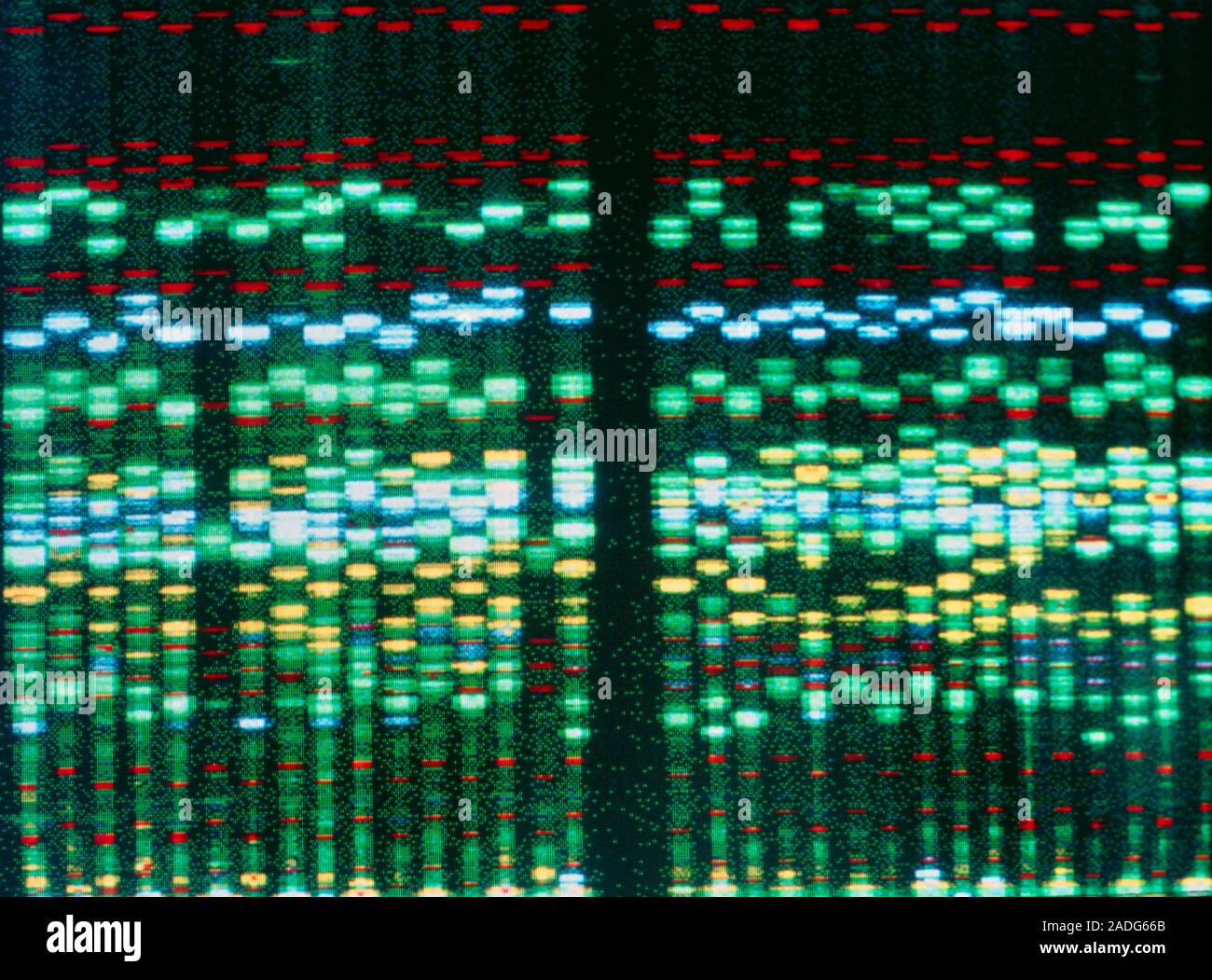 Obesity DNA research. Computer display of DNA (deoxyribonucleic acid ...