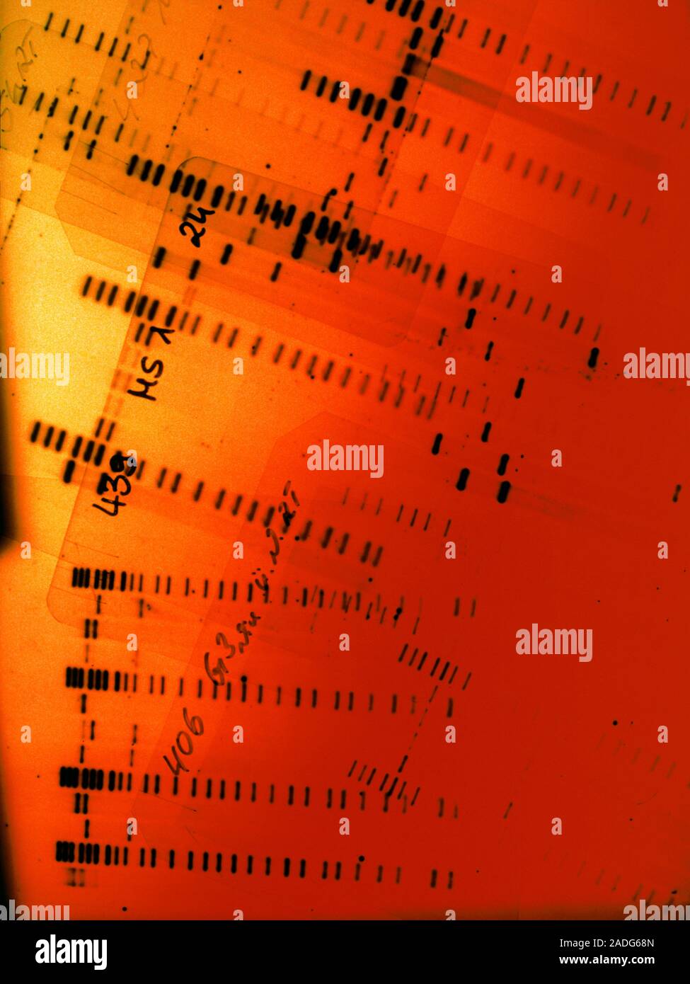 Gene mapping. Deoxyribonucleic Acid (DNA) autorad iograms prepared as