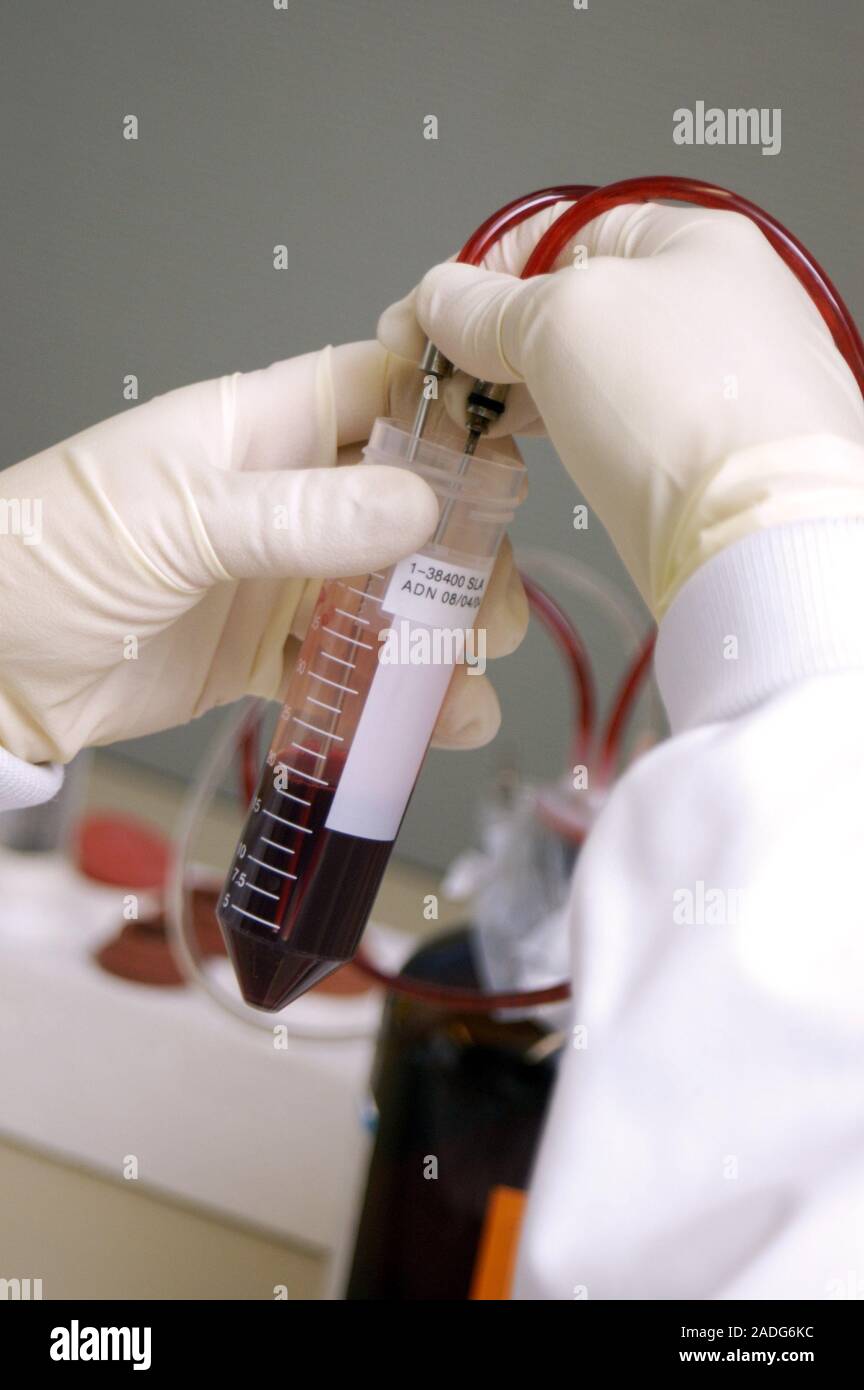 DNA extraction. Image 3 of 10. removing red blood cells and