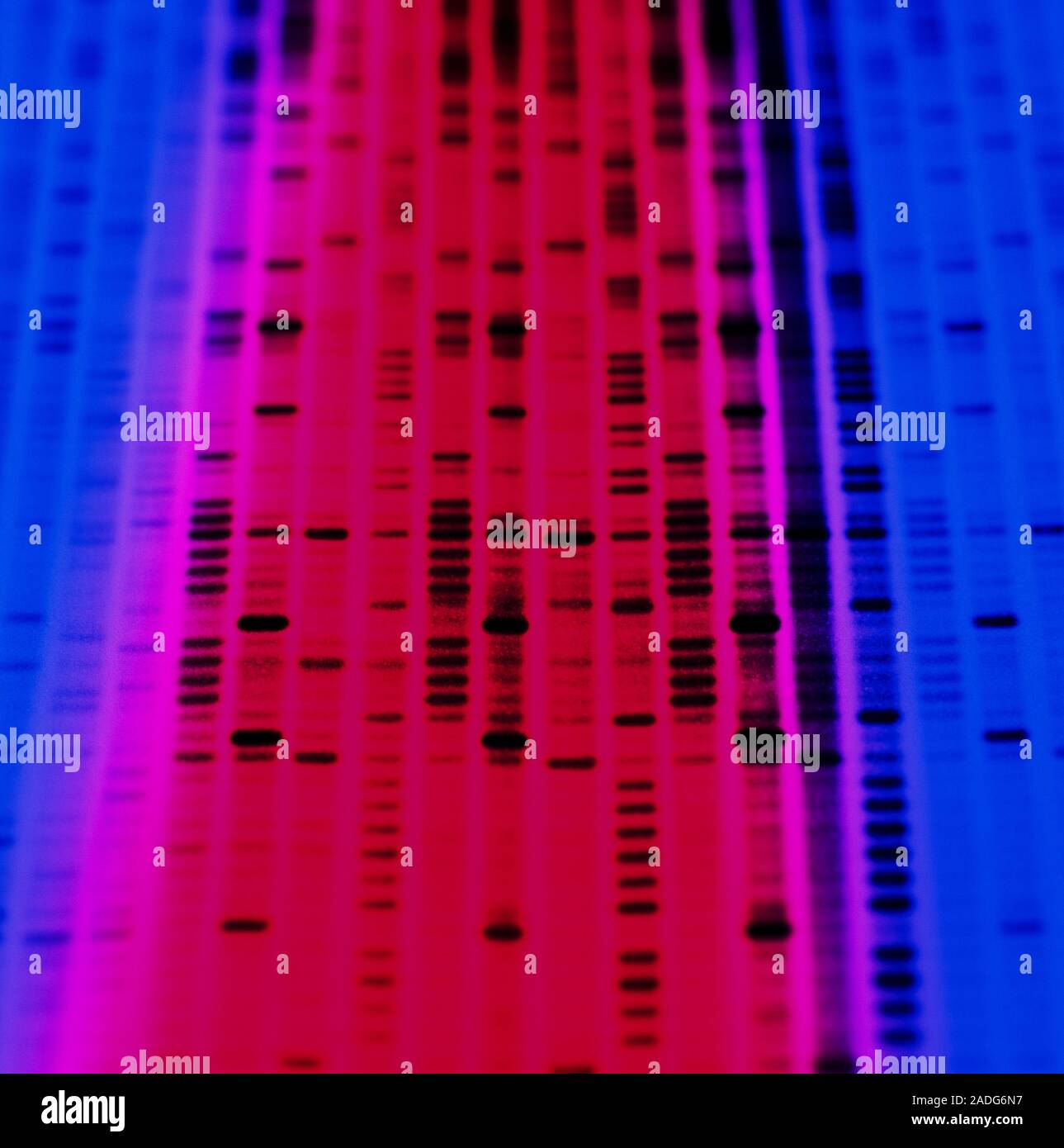 DNA autoradiogram. DNA (deoxyribonucleic acid) consists of two sugar