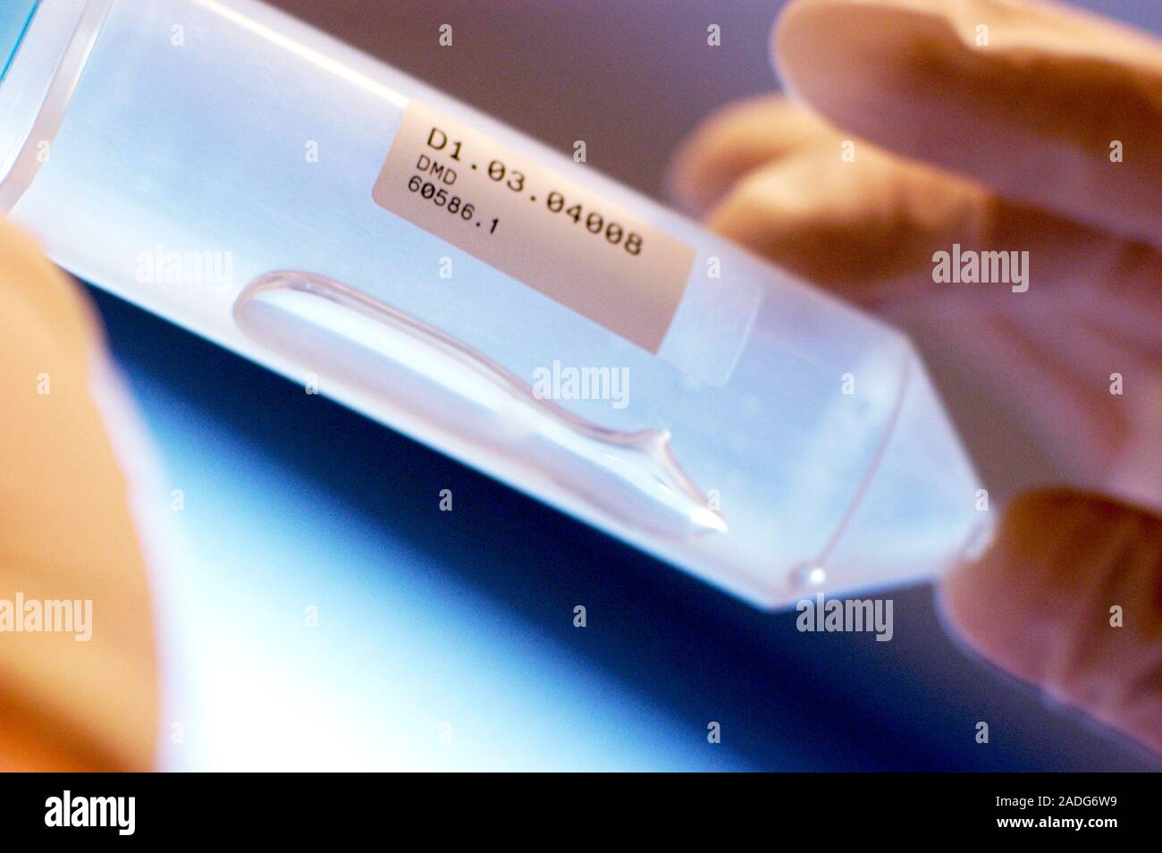 DNA sample. Sample vial containing DNA (deoxyribonucleic acid), the ...