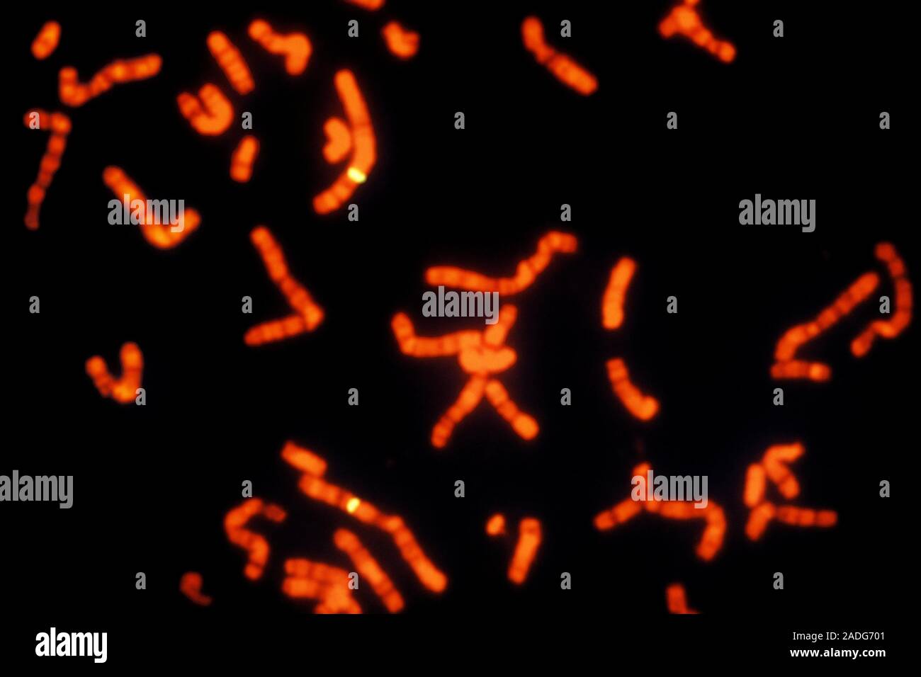 FISH micrograph of chromosomes. FISH (fluorescence in-situ ...