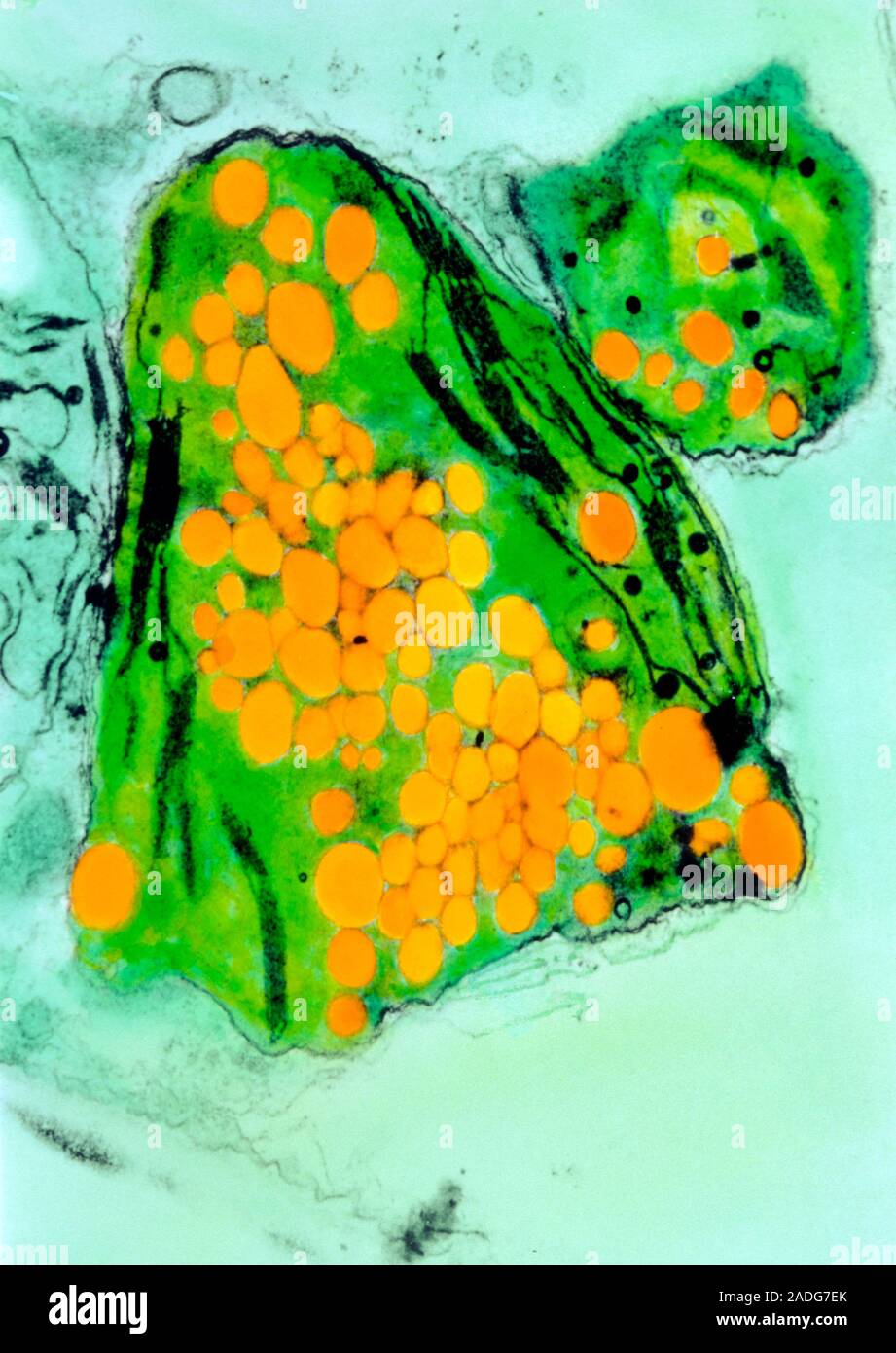 Plastic made in a plant cell. Colour Transmission Electron Micrograph (TEM) of a section through a plant chloroplast containing granules of plastic. T Stock Photo