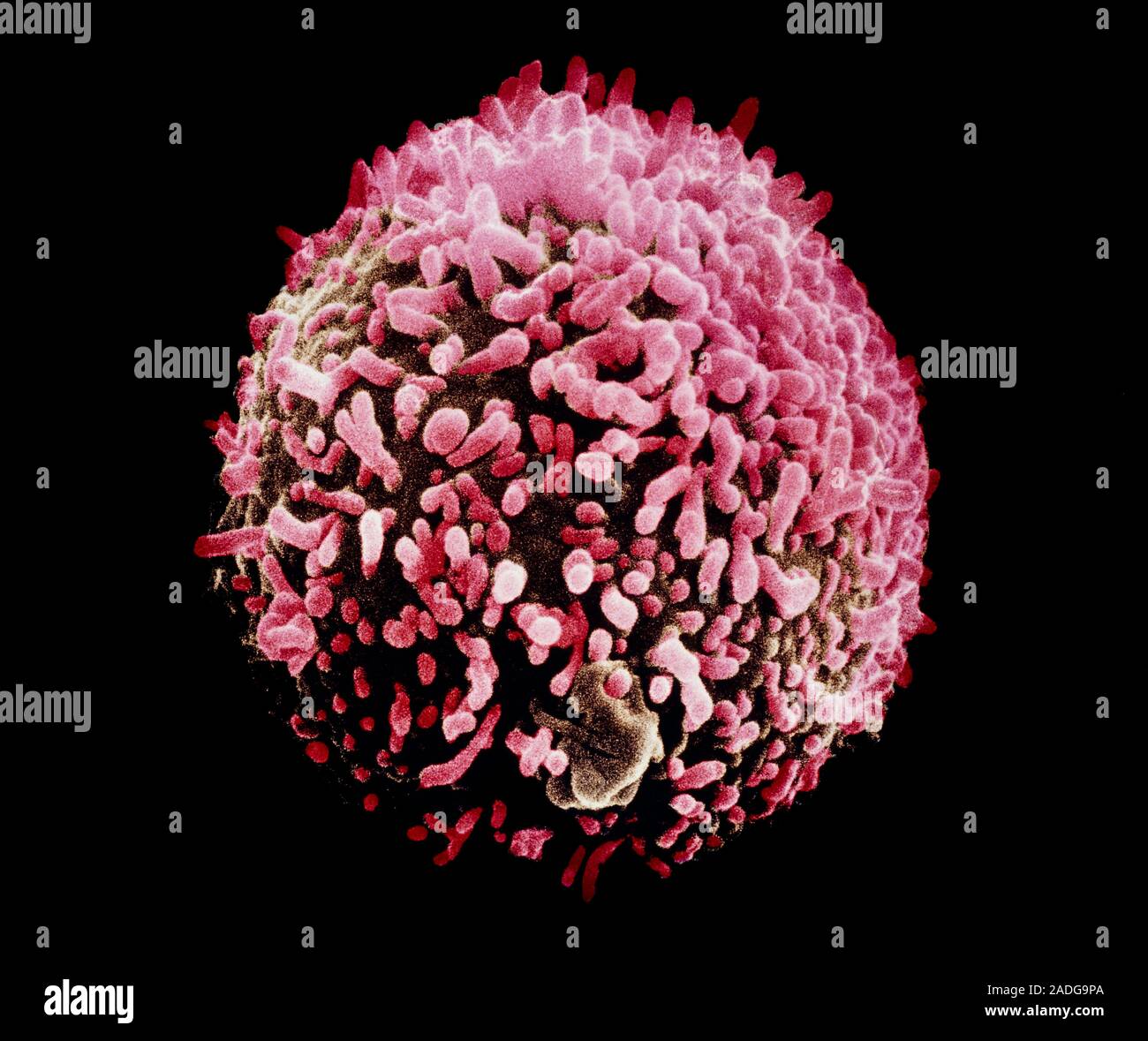Falsecolour scanning electron micrograph of a hybridoma cell producing