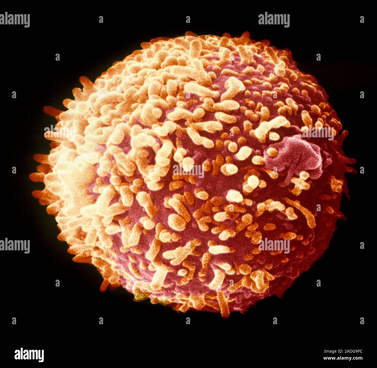 иммунодиагностика опухолей иммунология. методы создания гибридом. гибрид клетка. гибридные клетки растения. методы получения моноклональных антител.