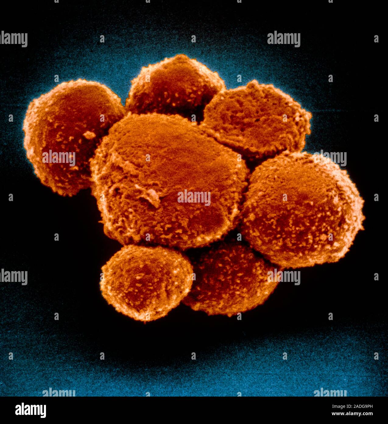 Falsecolour scanning electron micrograph of a cluster of hybridoma