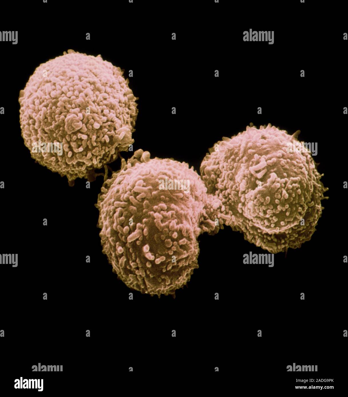 Falsecolour scanning electron micrograph (SEM) of hybridoma cells