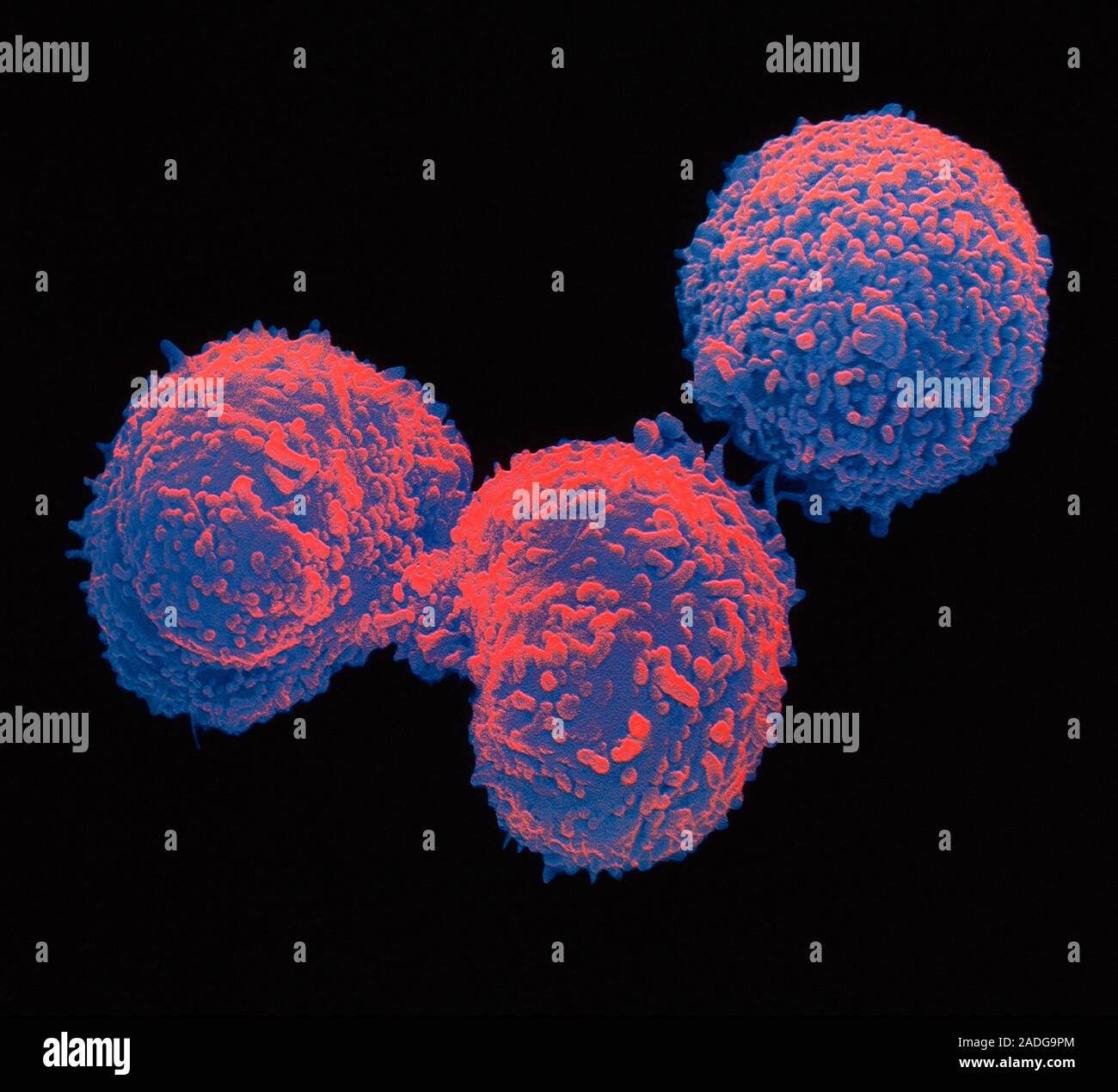 Falsecolour scanning electron micrograph of hybridoma cells, producing