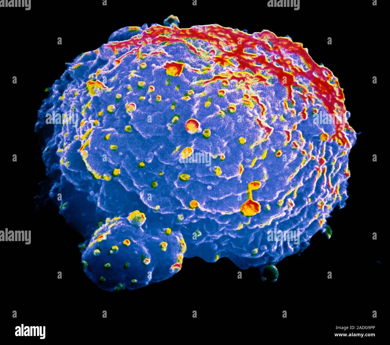 Falsecolour scanning electron micrograph (SEM) of a single hybridoma