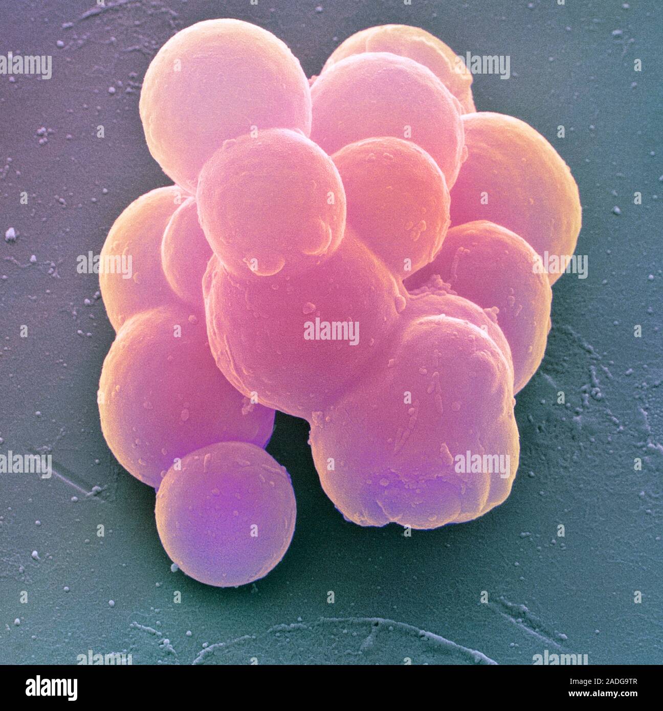 Stem cells. Coloured scanning electron micrograph (SEM) of stem cells