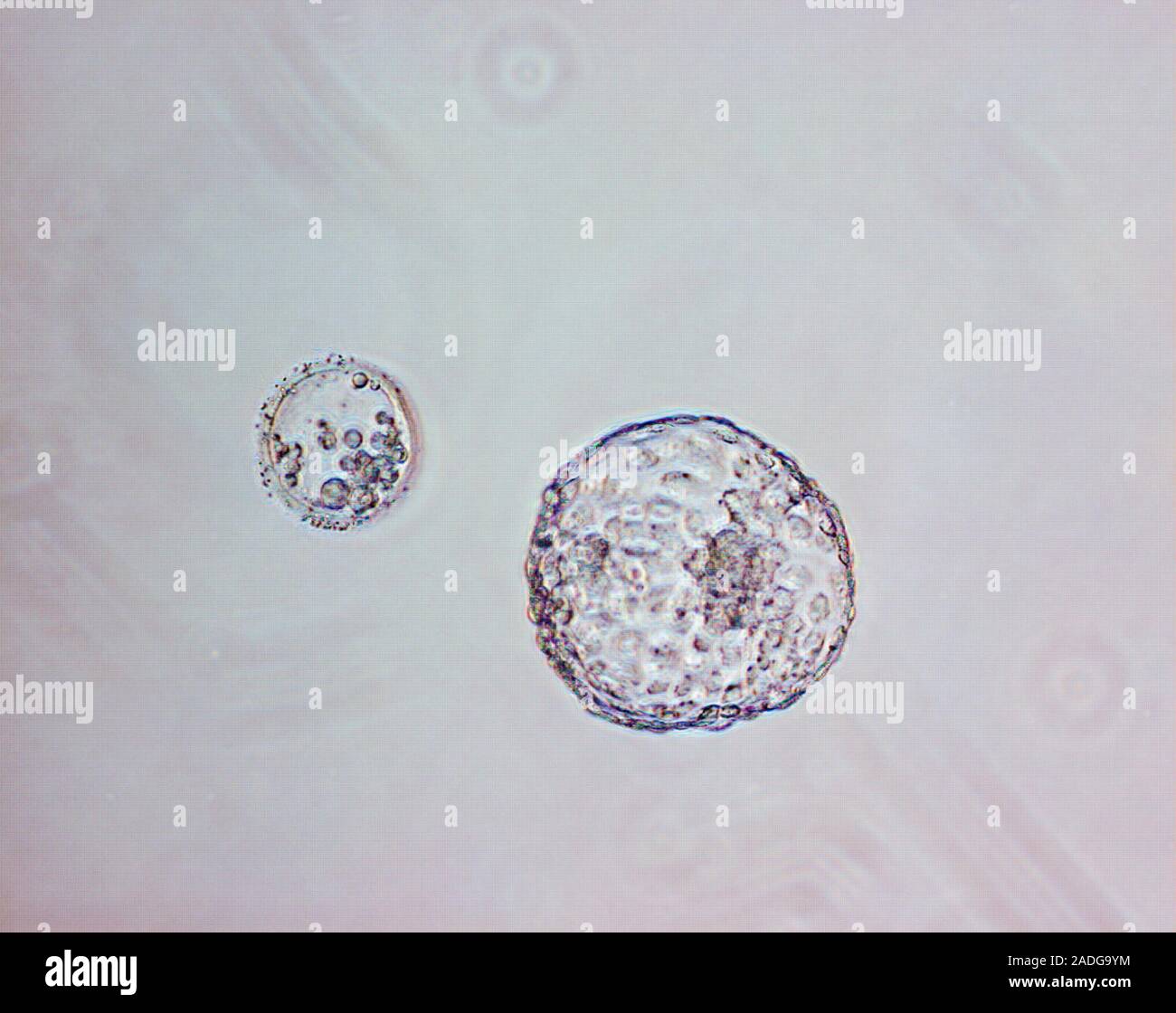 blastocyst hatching