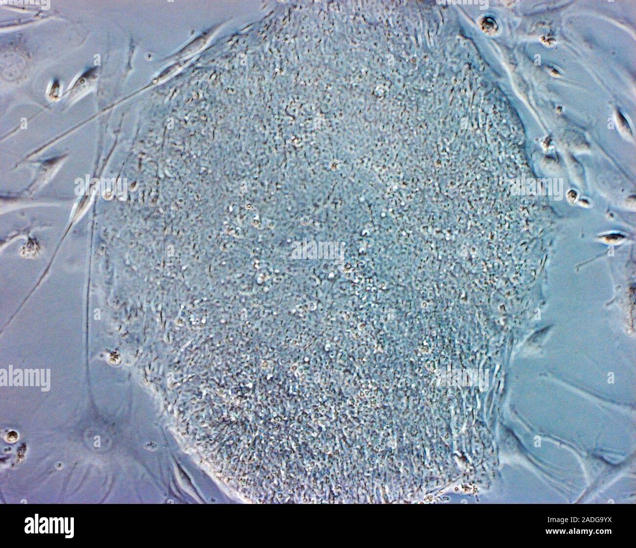 Stem cells. Coloured light micrograph of human embryonic stem cells ...