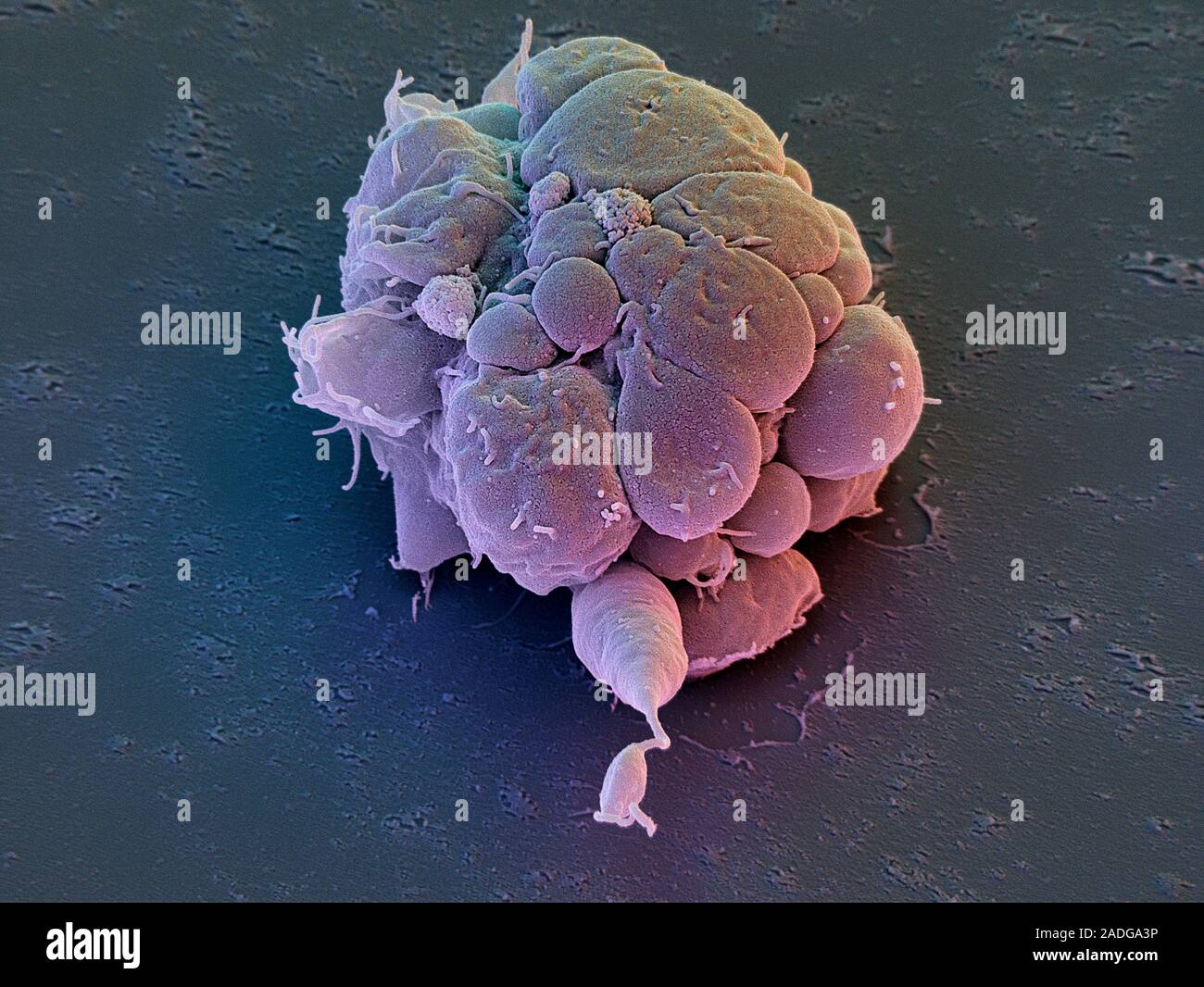 Stem cells. Coloured scanning electron micrograph (SEM) of a cluster of ...