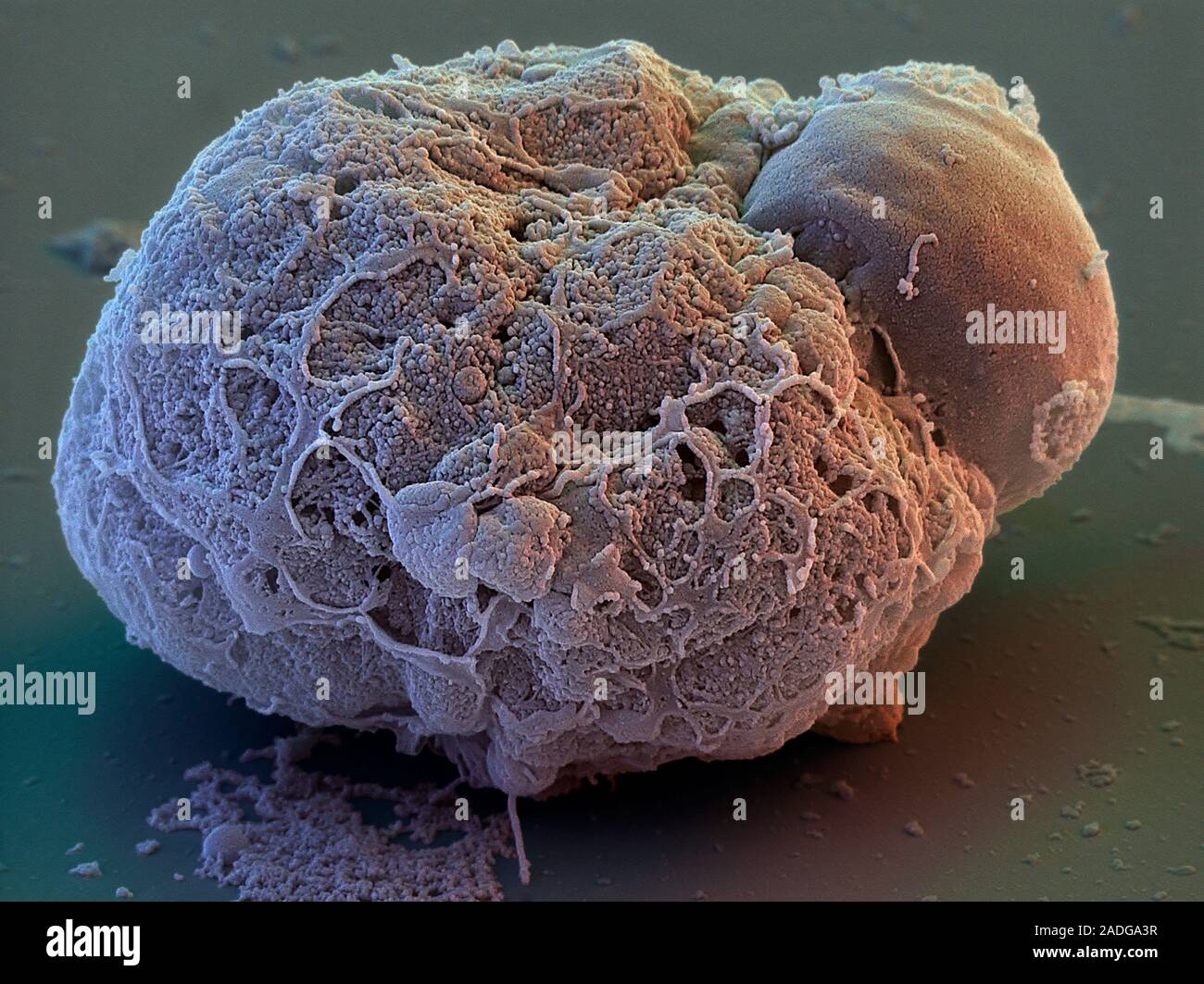 Stem cells. Coloured scanning electron micrograph (SEM) of a cluster of ...