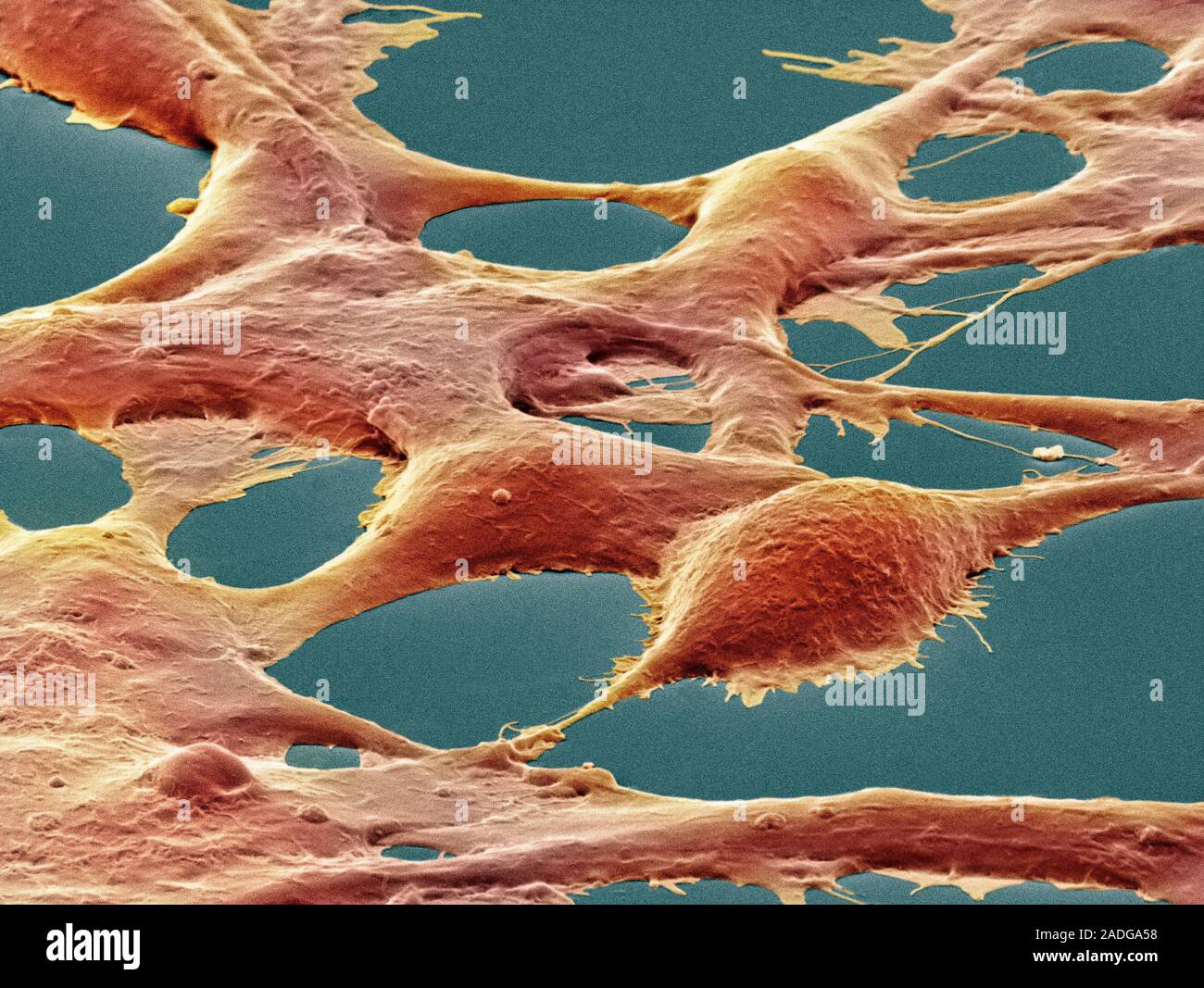 Human embryonic kidney cells coloured scanning electron micrograph