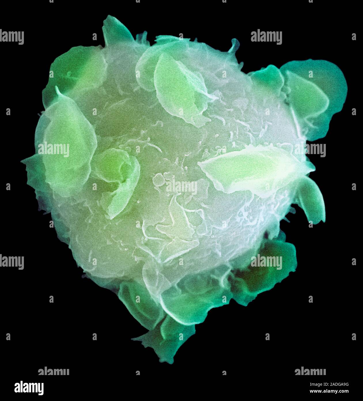 Bone marrow stem cell, coloured scanning electron micrograph (SEM