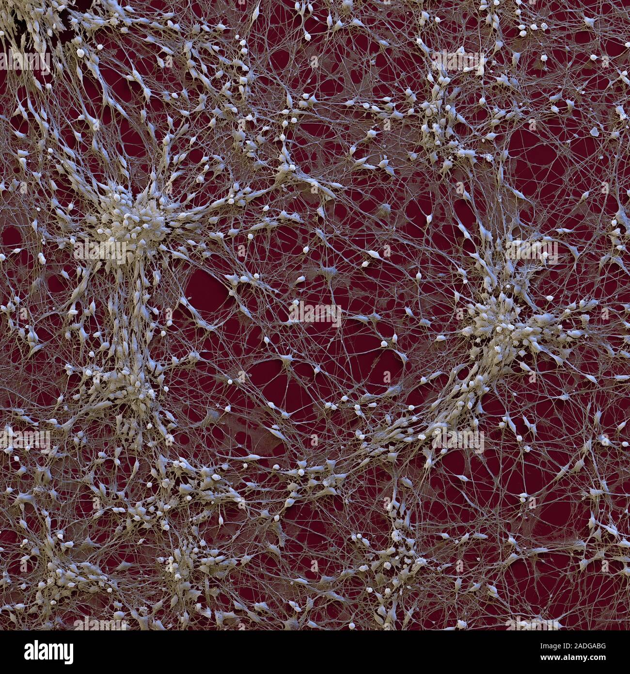 Human neural progenitor cells in a culture medium, coloured scanning ... Biology Diagrams