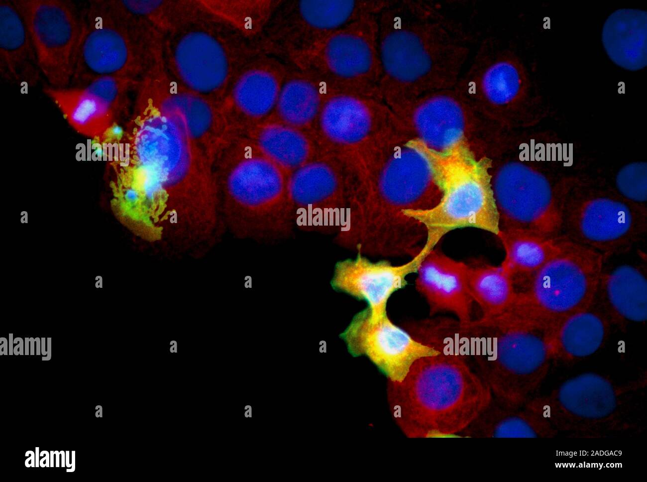 Cell after apoptosis. Immunofluorescent Light Micrograph of a culture ...