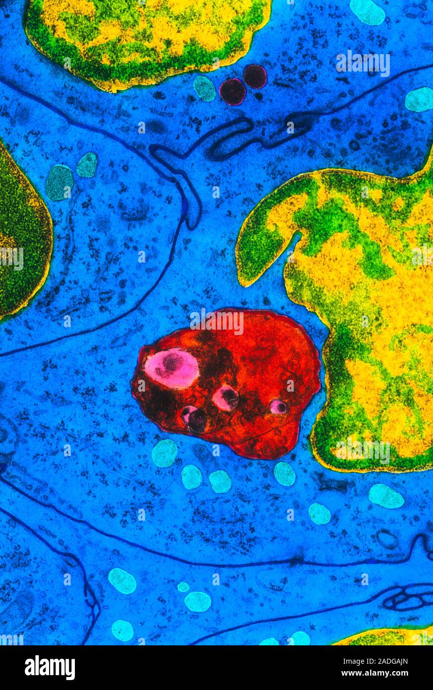 Secondary lysosome. Coloured Transmission Electron Micrograph (TEM) of ...