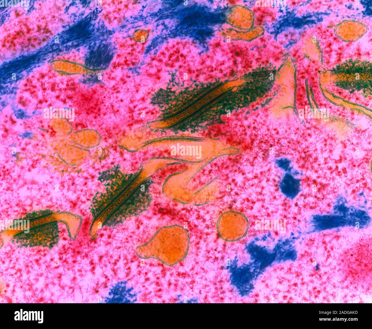 Desmosomes. Coloured transmission electron micrograph (TEM) of a ...
