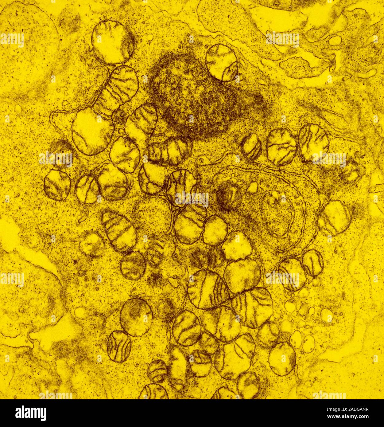 False colour transmission electron micrograph (TEM) of a thin section ...