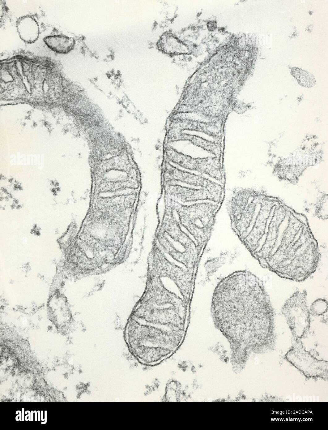 mitochondria-transmission-electron-micrograph-of-mitochondria-from