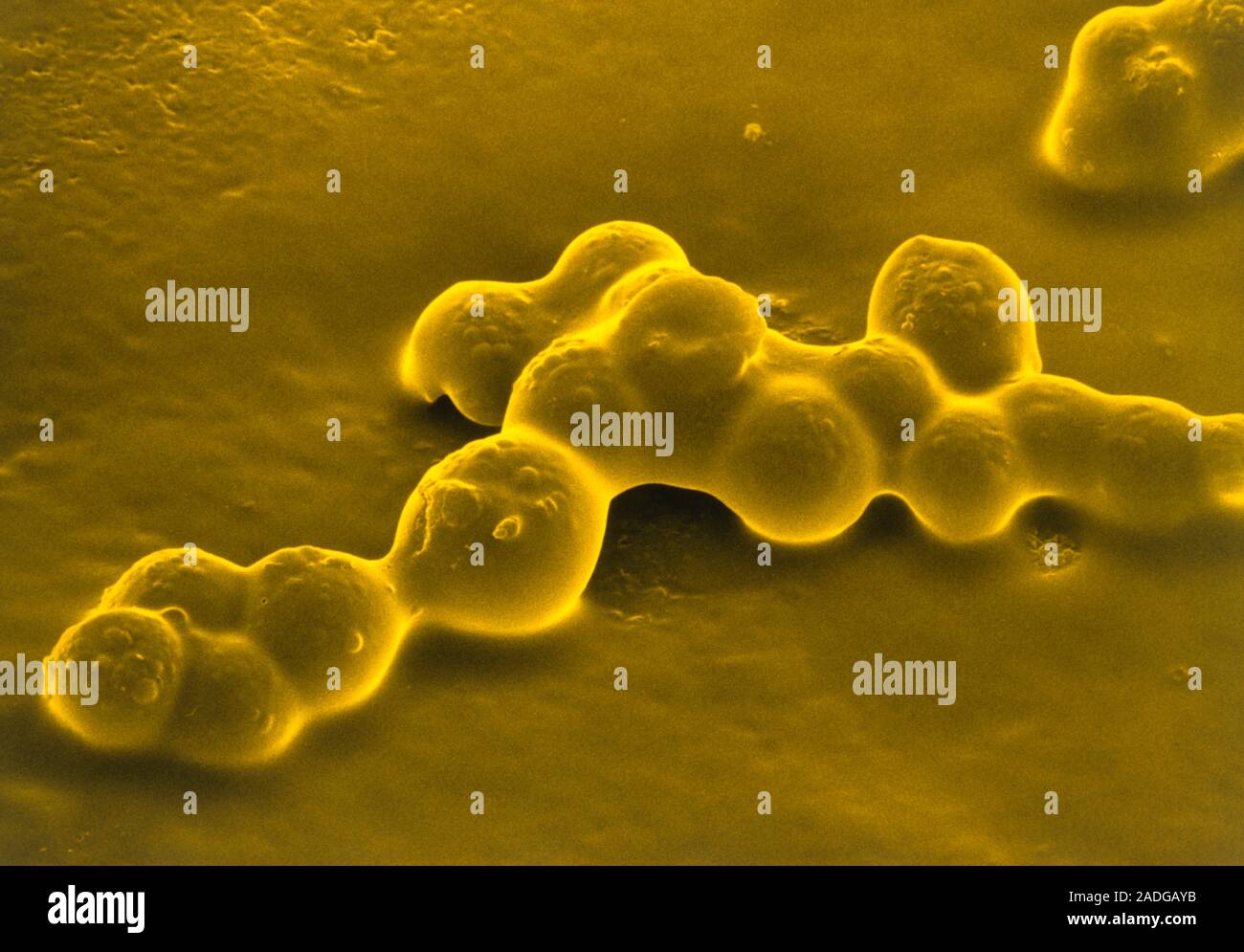 False colour scanning electron micrograph of a scratch & sniff sticker ...