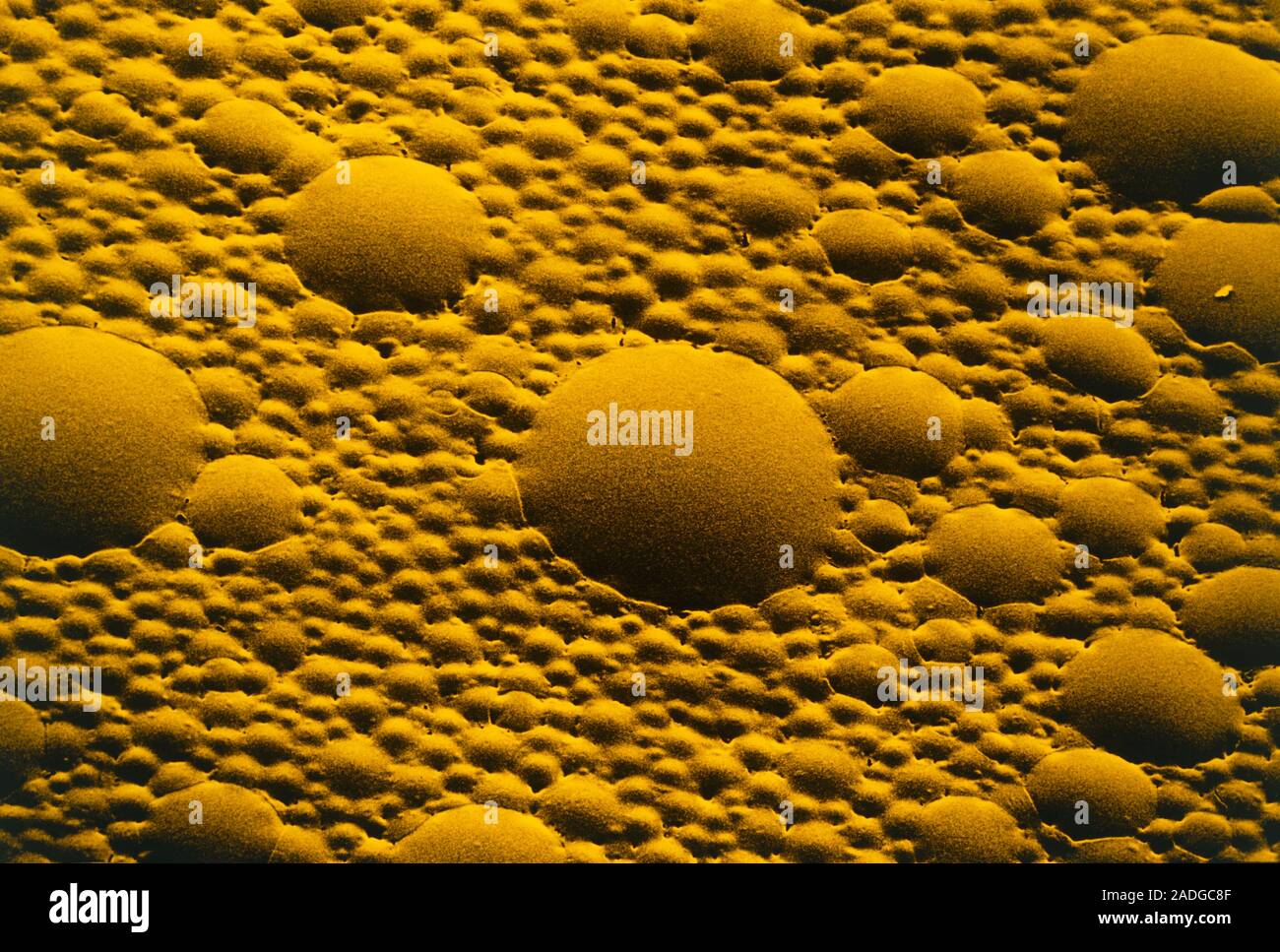 False colour freeze fractured scanning electron micrograph of a dollop