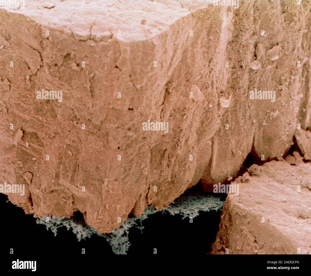Eggshell. Coloured scanning electron micrograph (SEM) of cracked shell ...