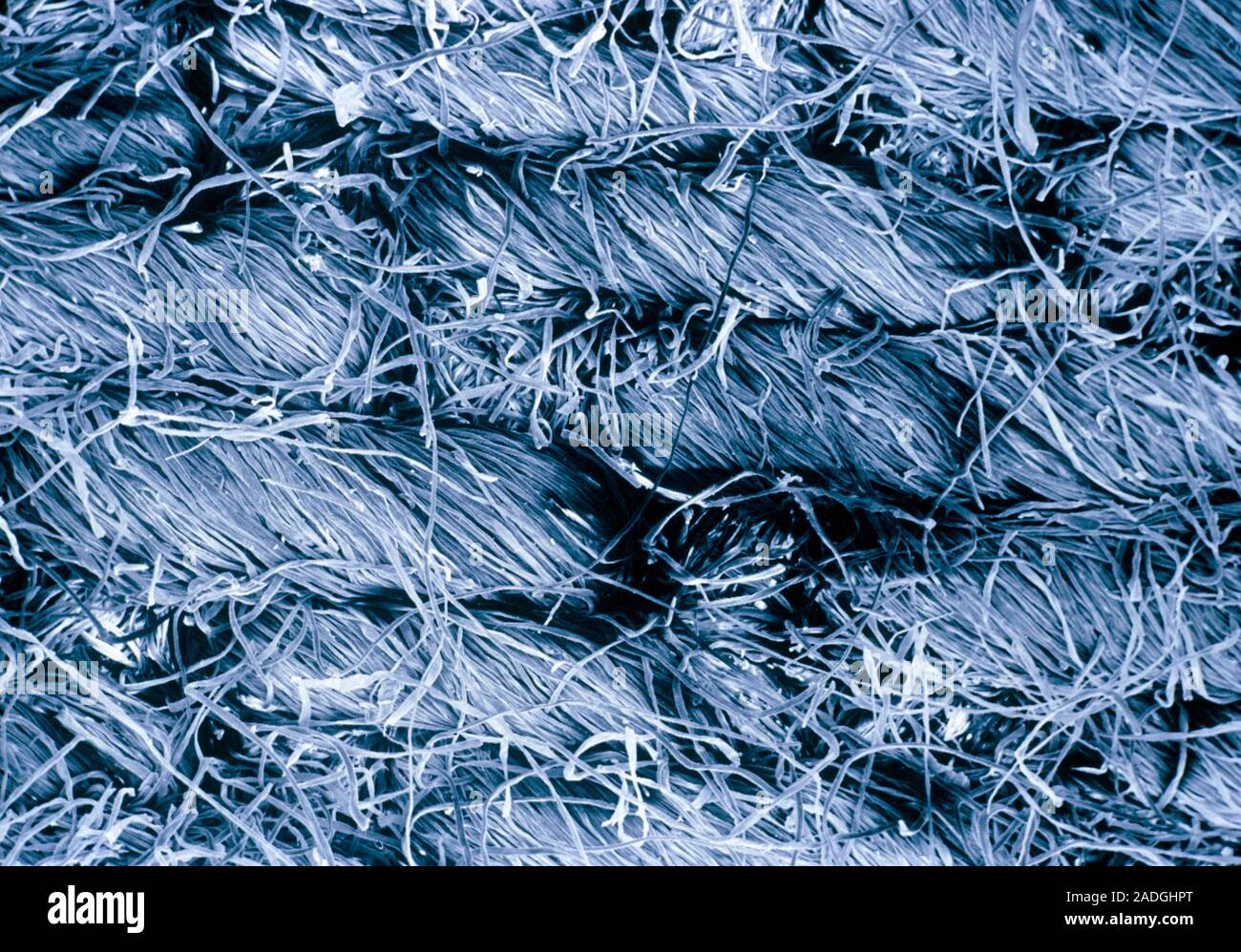 False-colour scanning electron micrograph (SEM) of a piece of denim ...