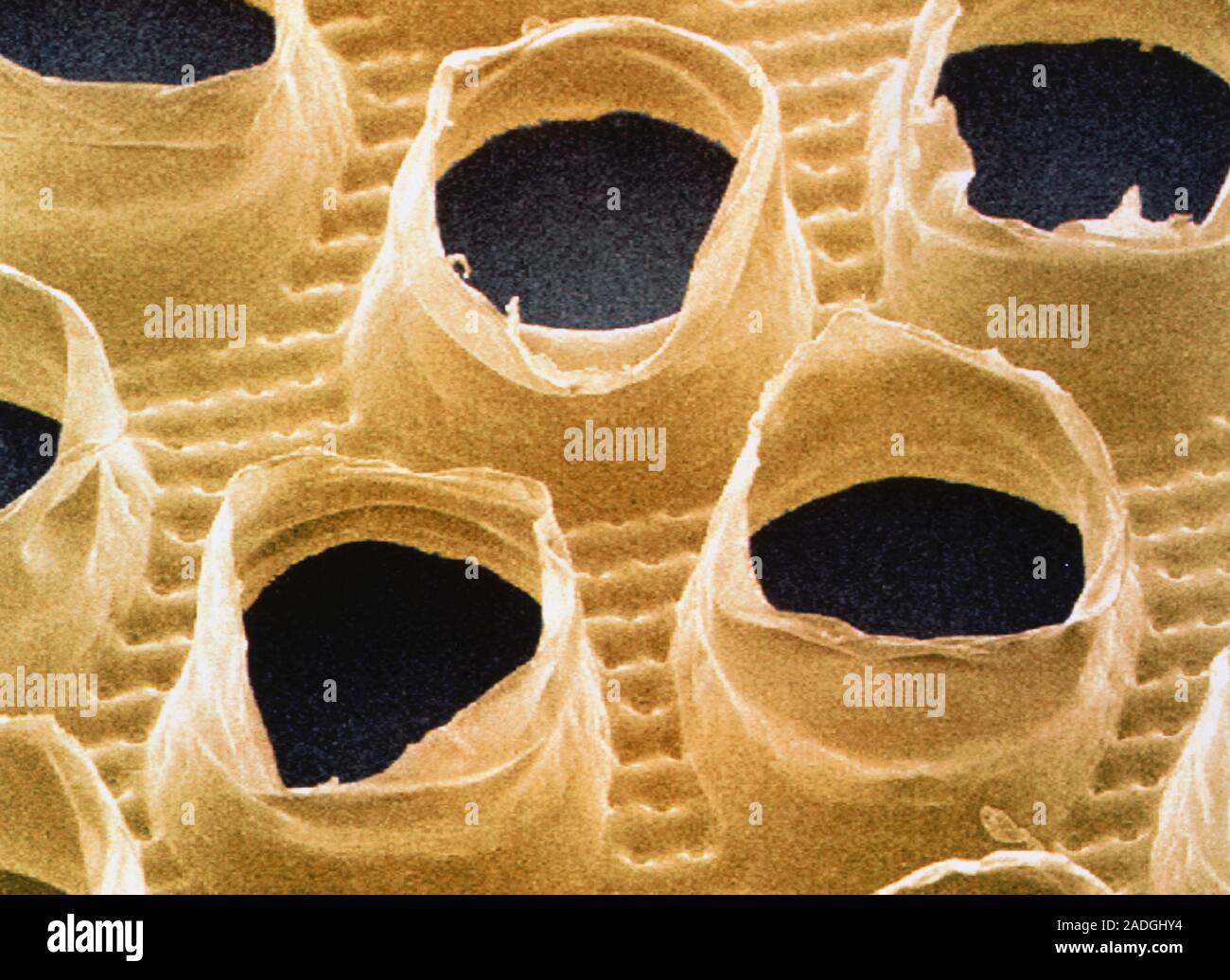 Sanitary towel. Coloured scanning electron micrograph (SEM) of the ...