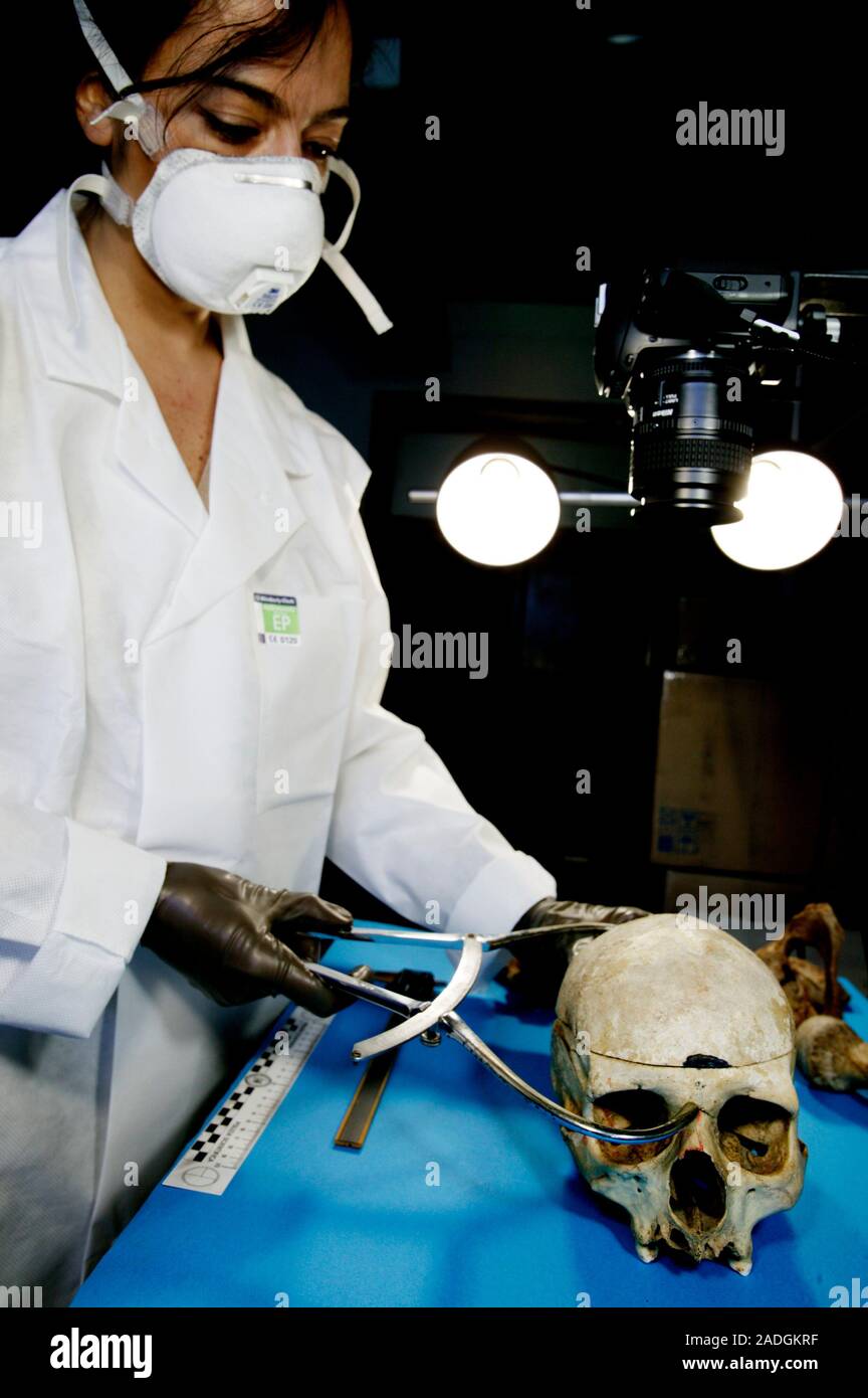 Forensic measurements. Forensic scientist using calipers to measure the