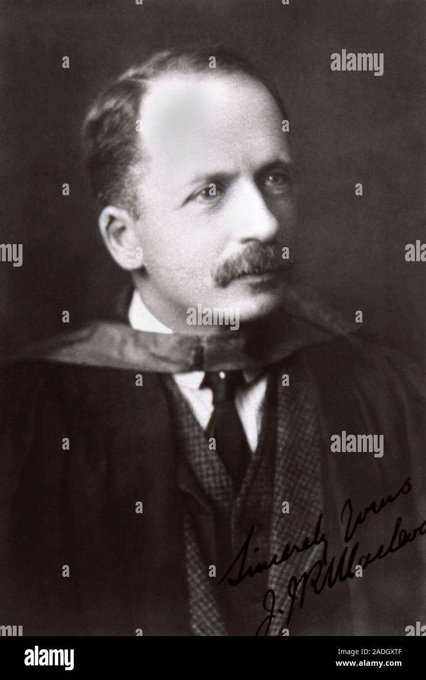John J. R. Macleod (18761935), Scottish physician, physiologist