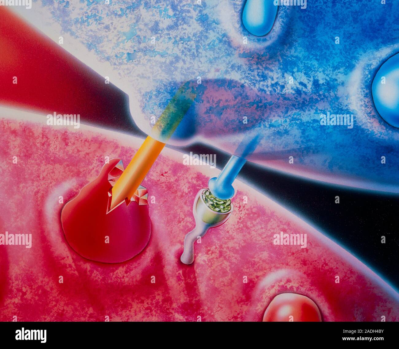 Artwork entitled Inside the AIDS Virus