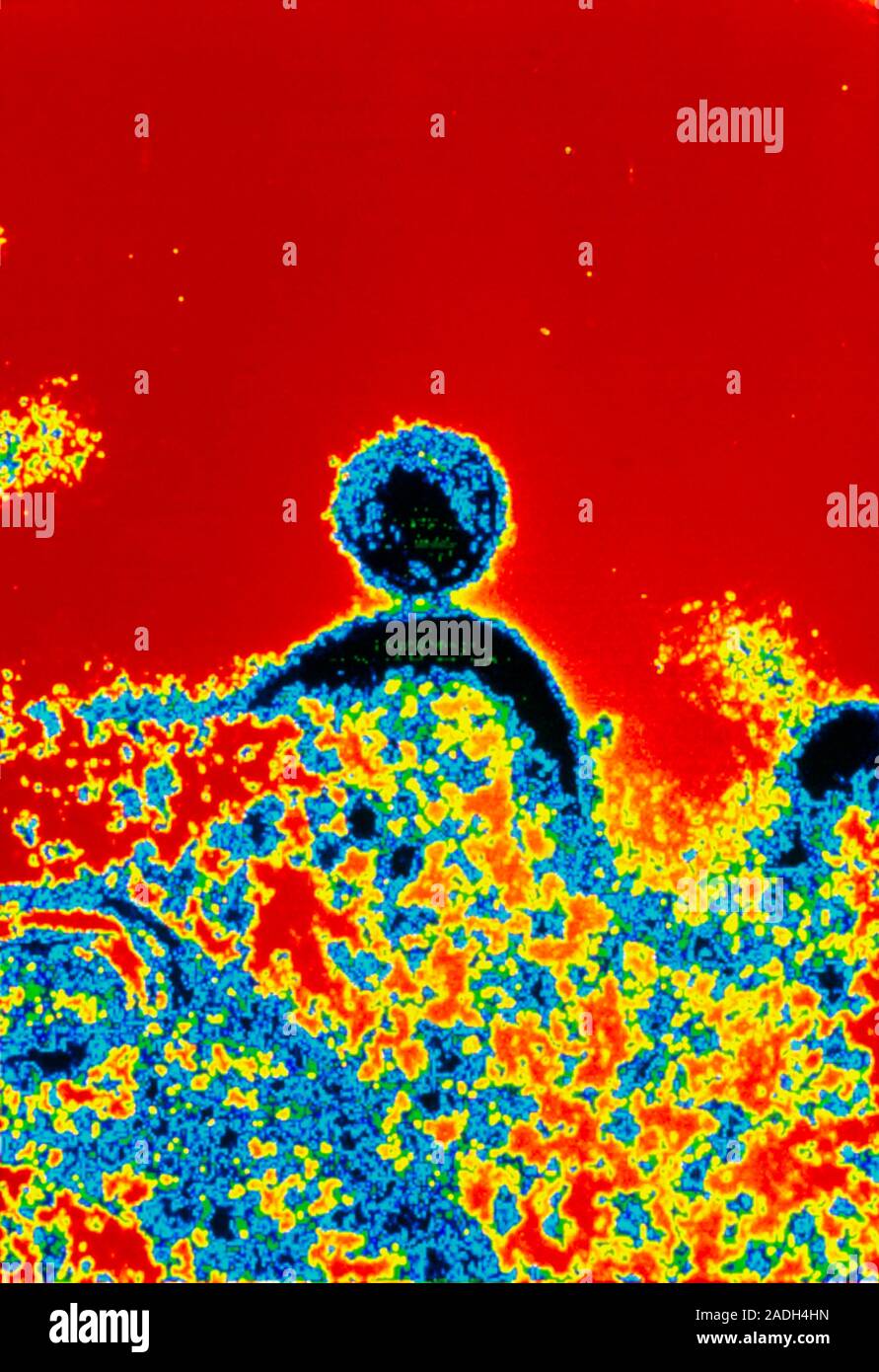 AIDS virus. Coloured Transmission Electron Micro- graph (TEM) of a ...