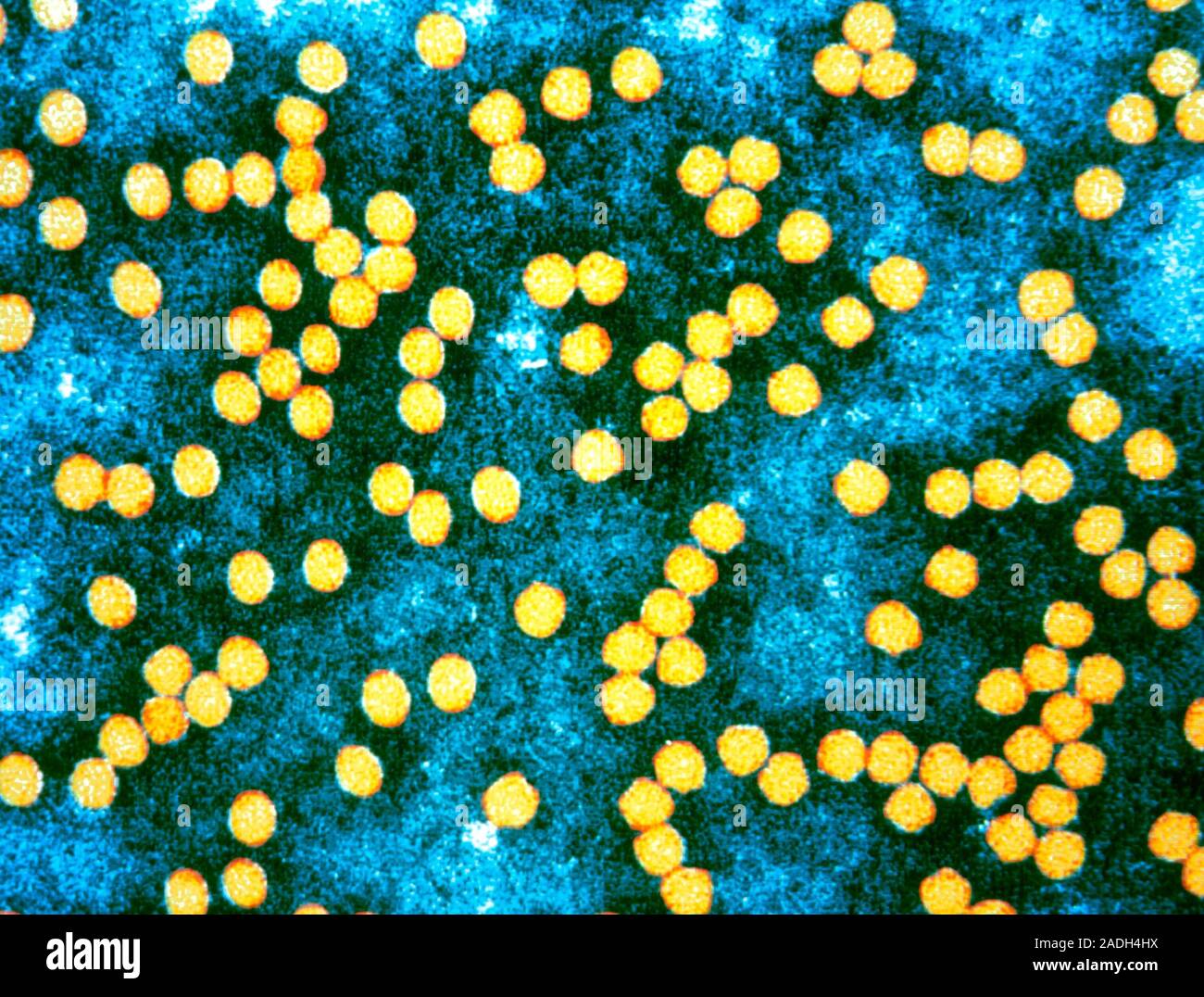 Foot & mouth disease virus. Coloured Transmission Electron Micrograph