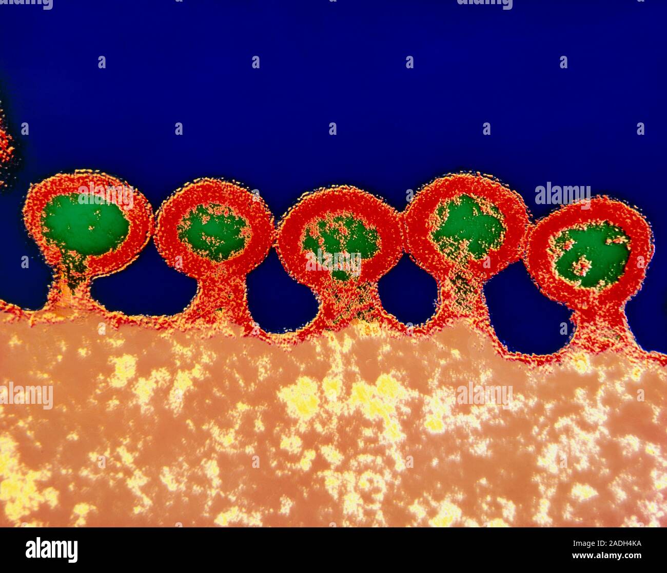 HIV virus. Coloured transmission electron micrograph of HIV viruses budding from the surface of