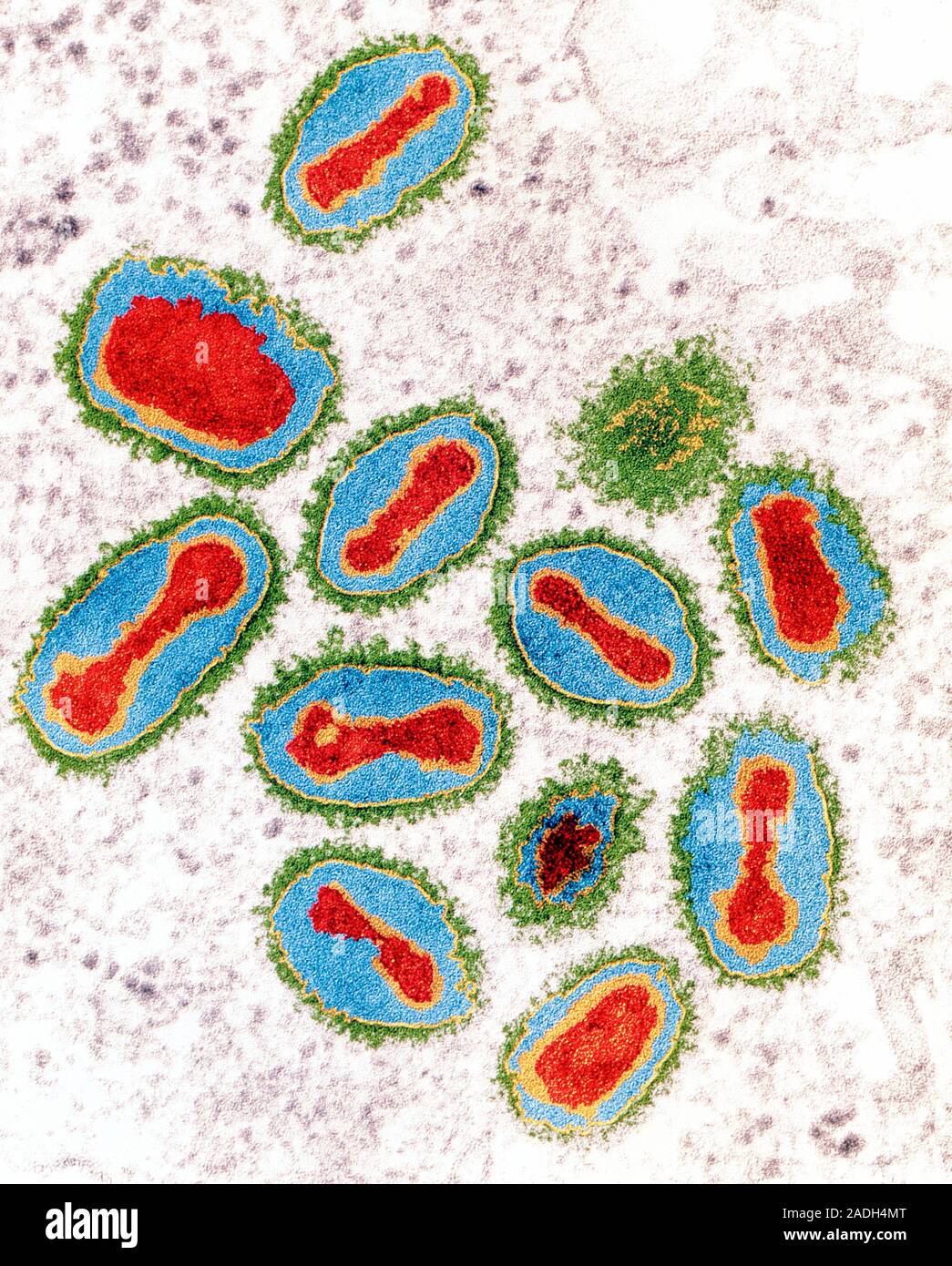 Smallpox viruses. Coloured Transmission Electron Micrograph (TEM) of a ...