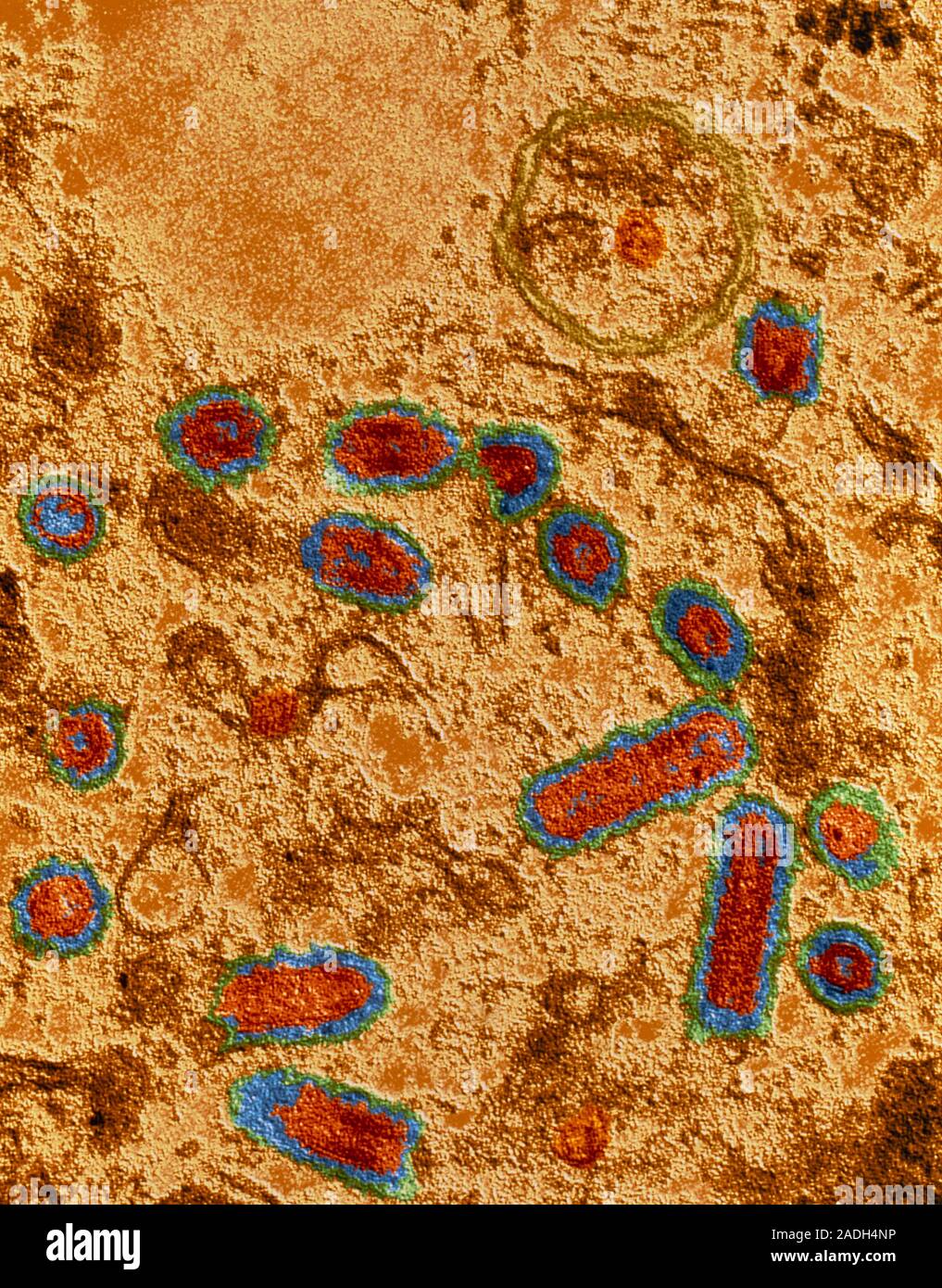Rabies Infected Cell Coloured Transmission Electron Micrograph Tem Of A Section Through An Animal Cell Infected With Rabies Virus Particles The Vi Stock Photo Alamy